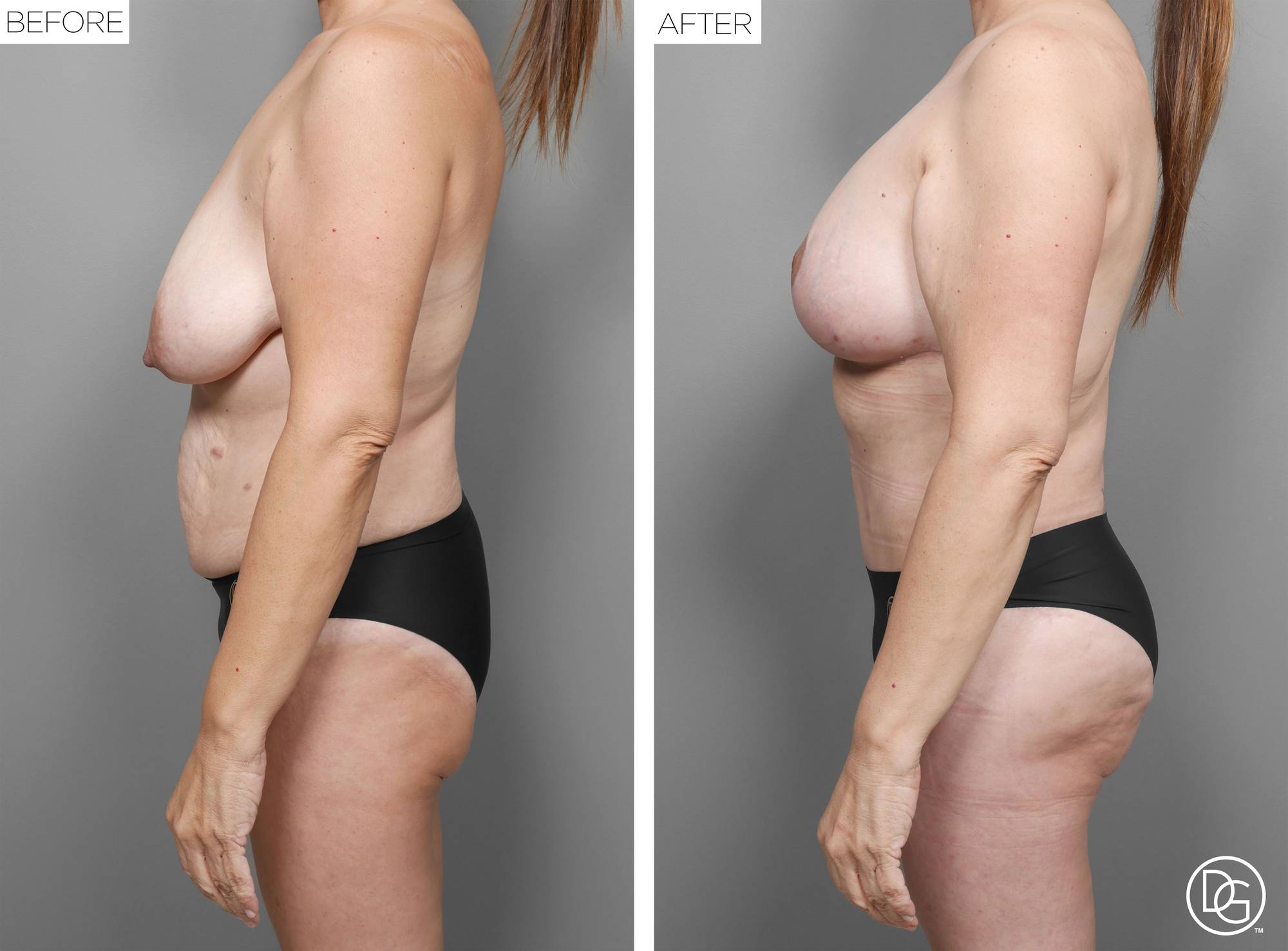 Before & After Image