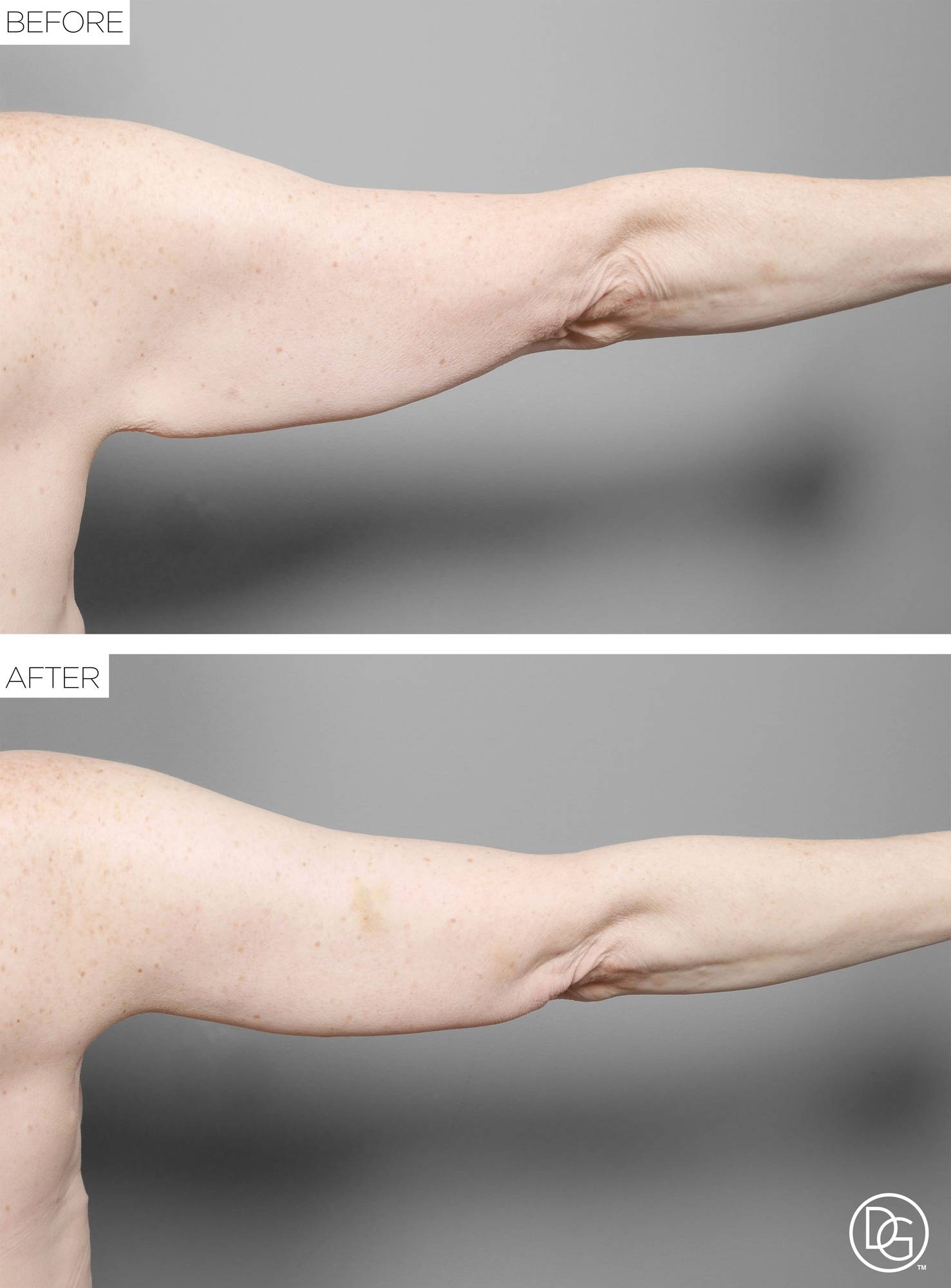 Before & After Image