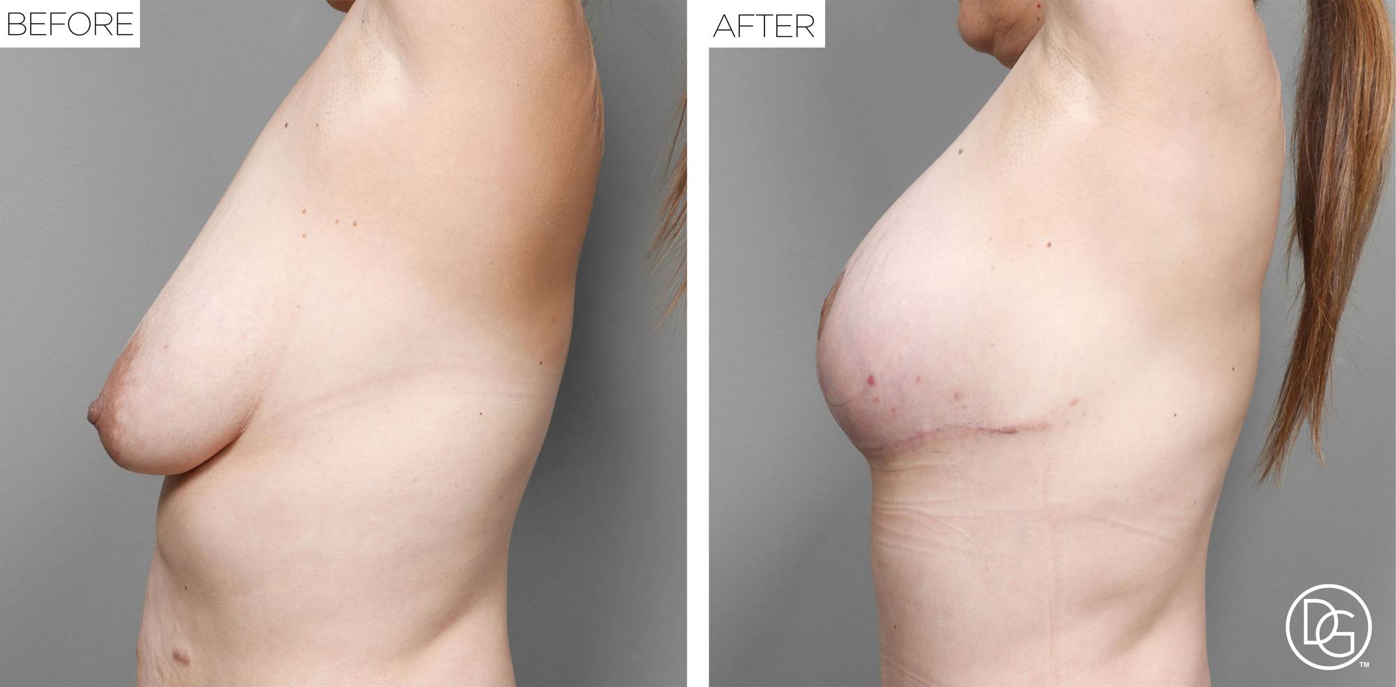 Before & After Image