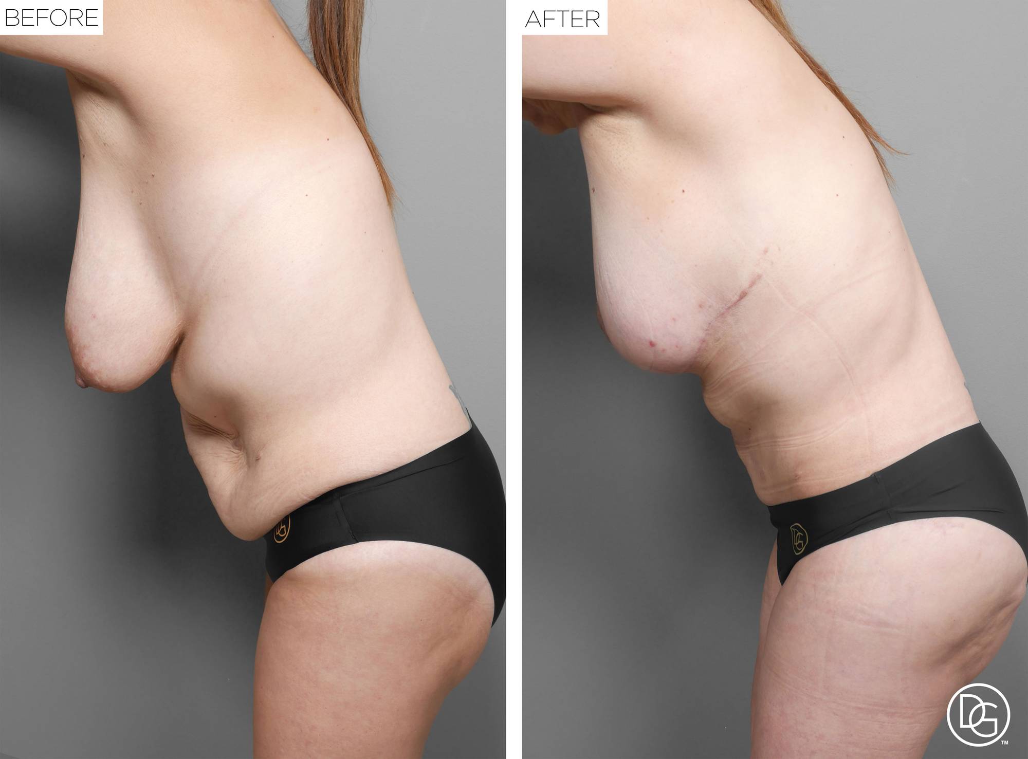 Before & After Image