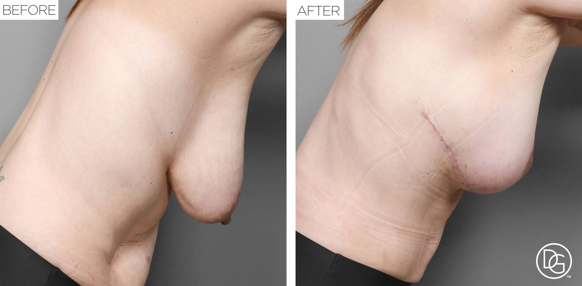 Before & After Image