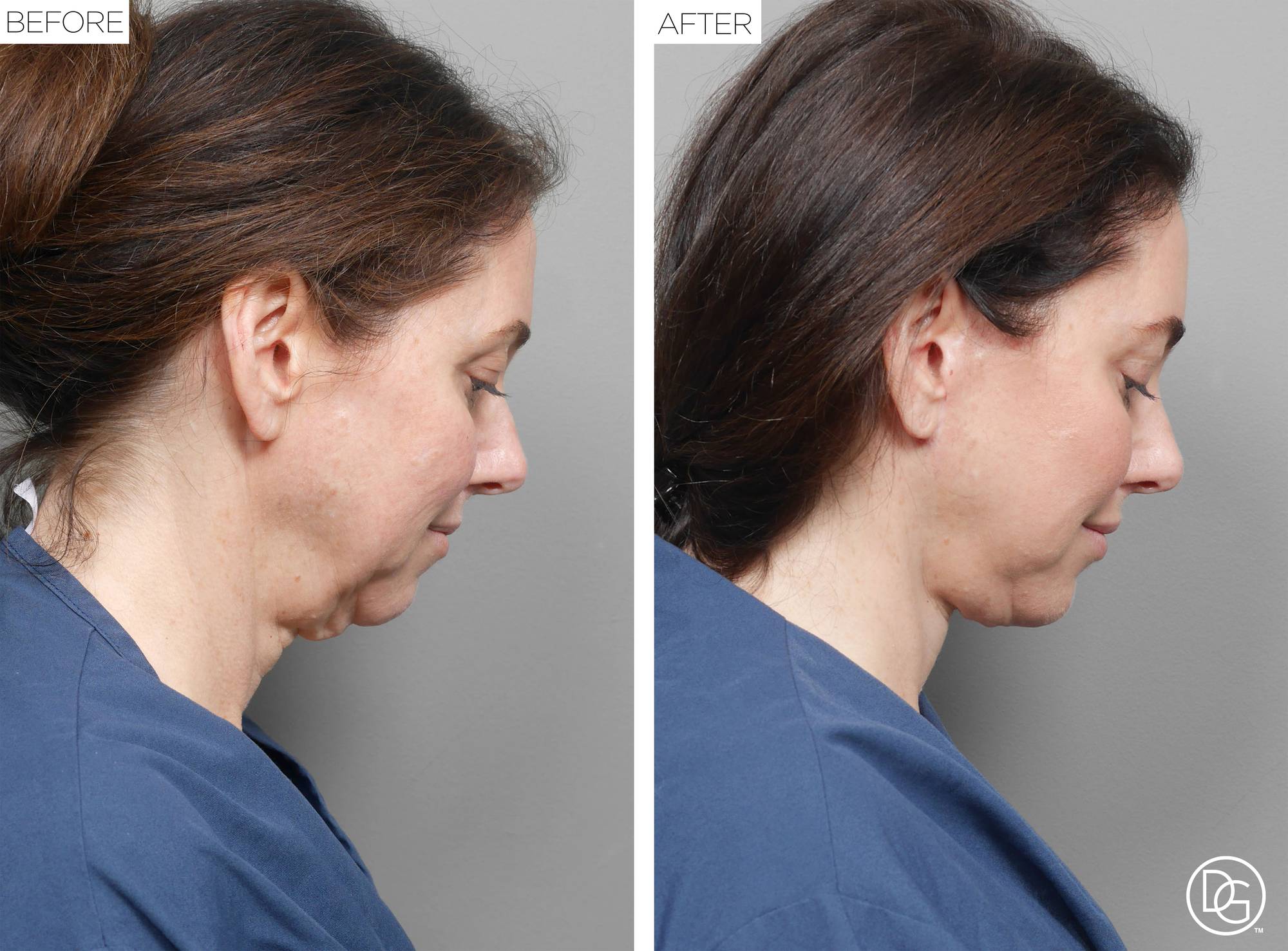 Before & After Image