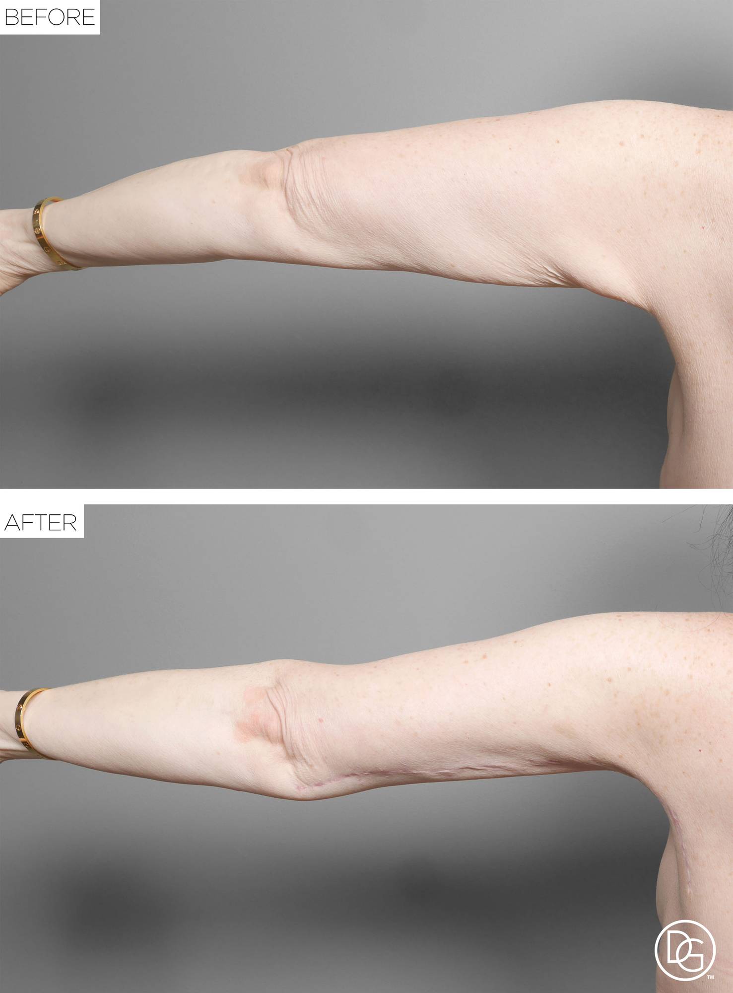 Before & After Image