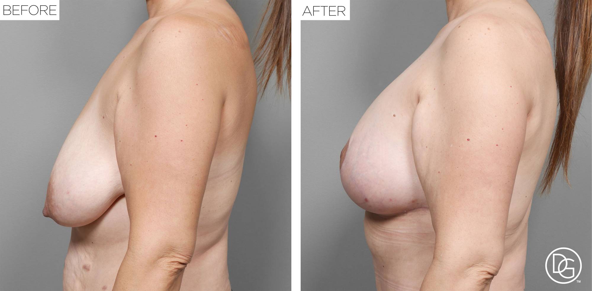 Before & After Image