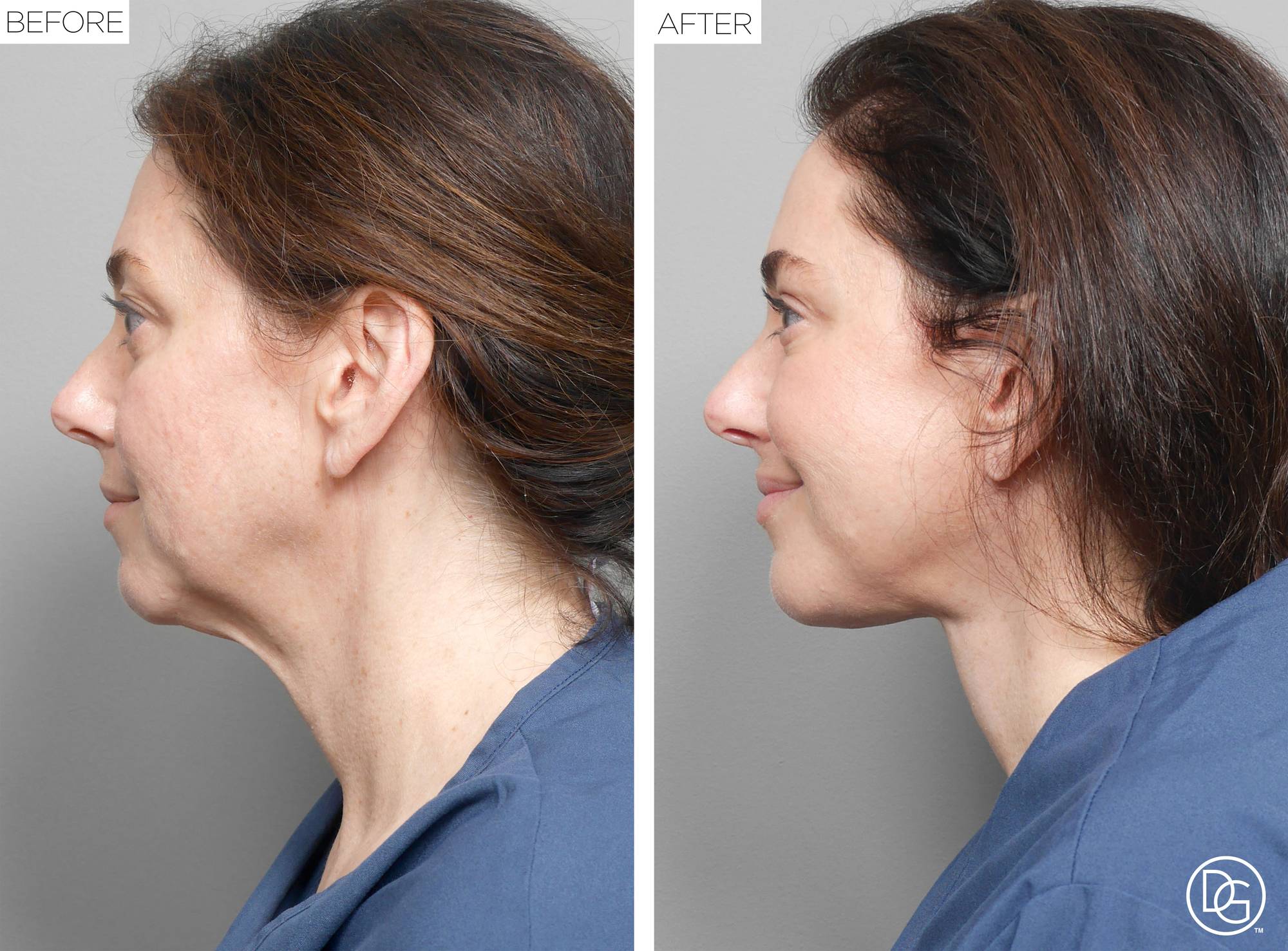 Before & After Image