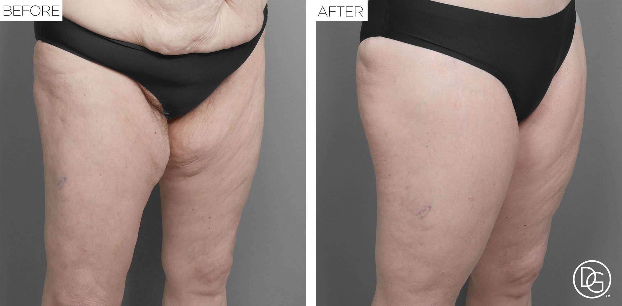 Before & After Image