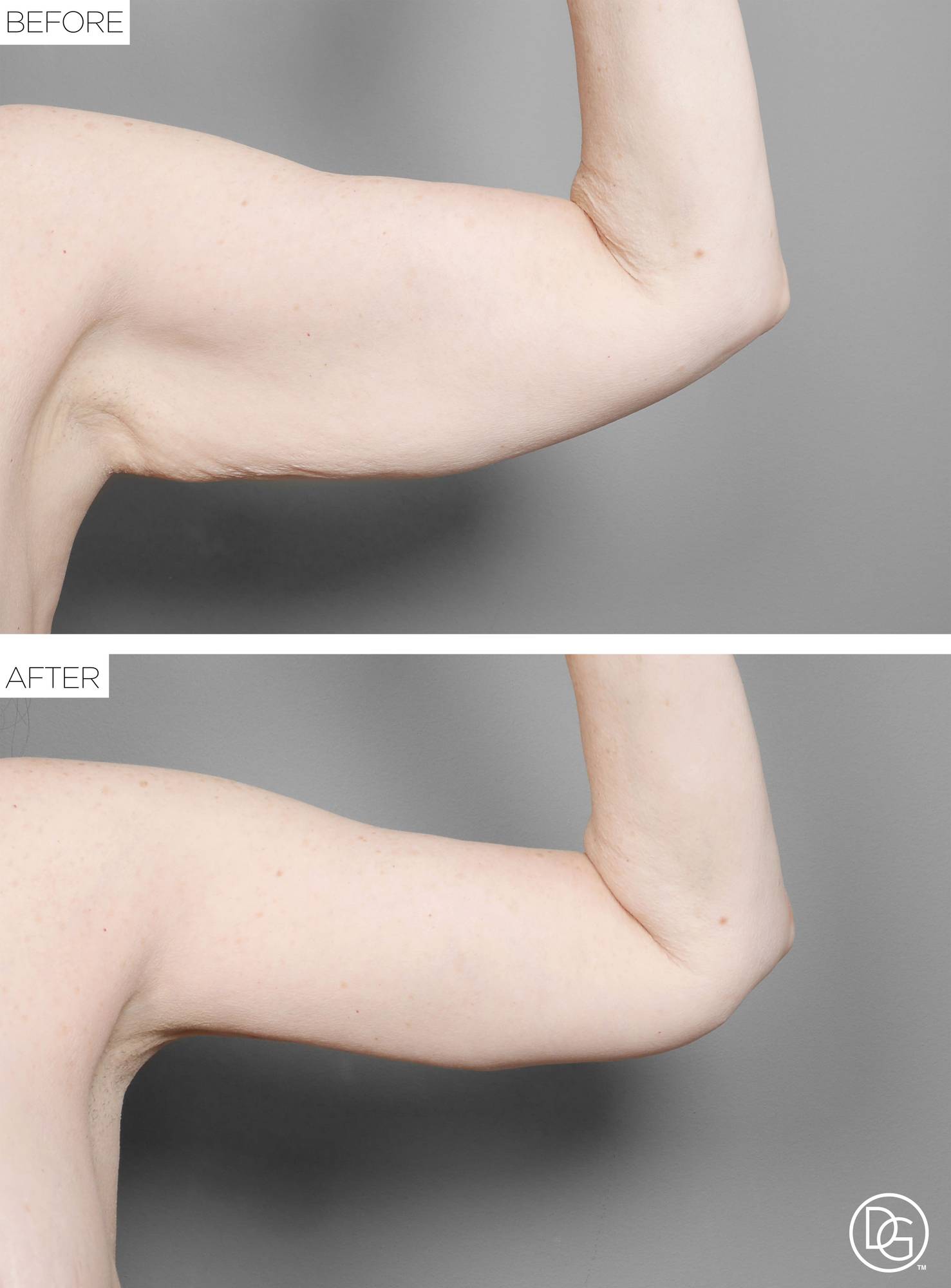 Before & After Image