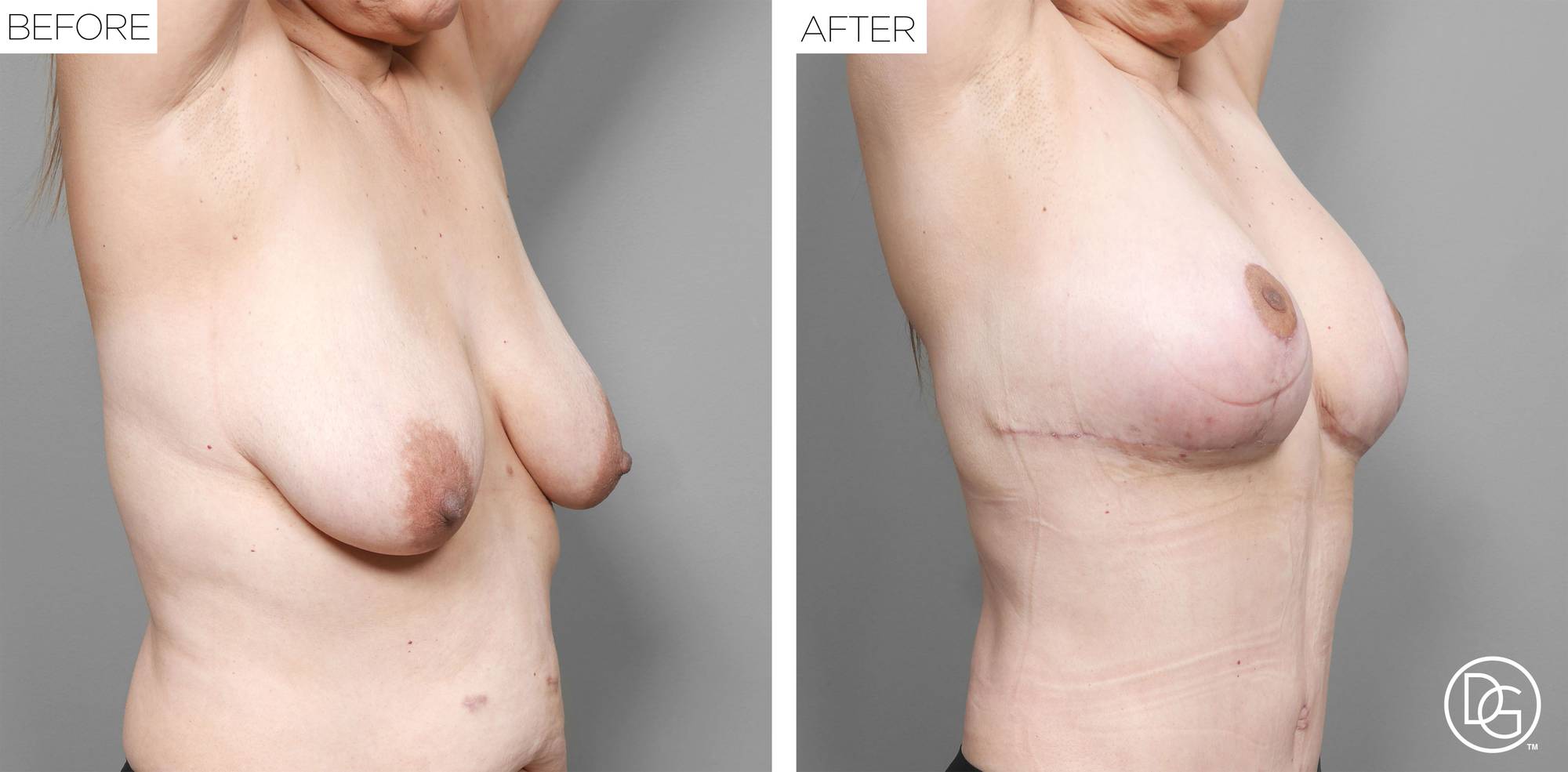 Before & After Image