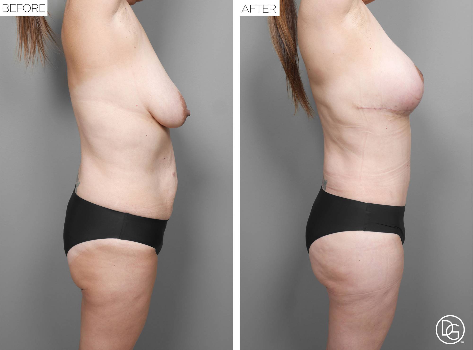 Before & After Image