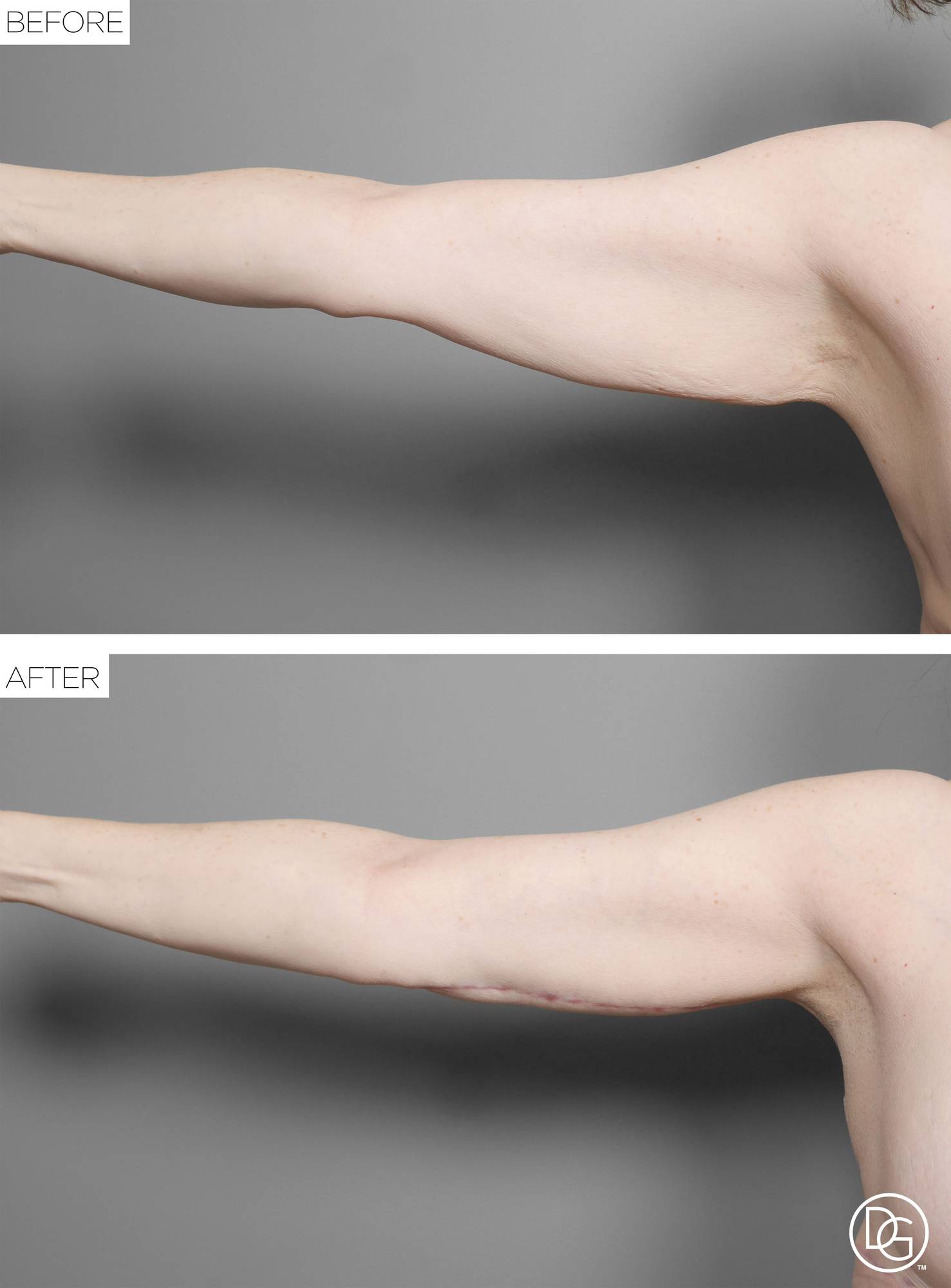 Before & After Image