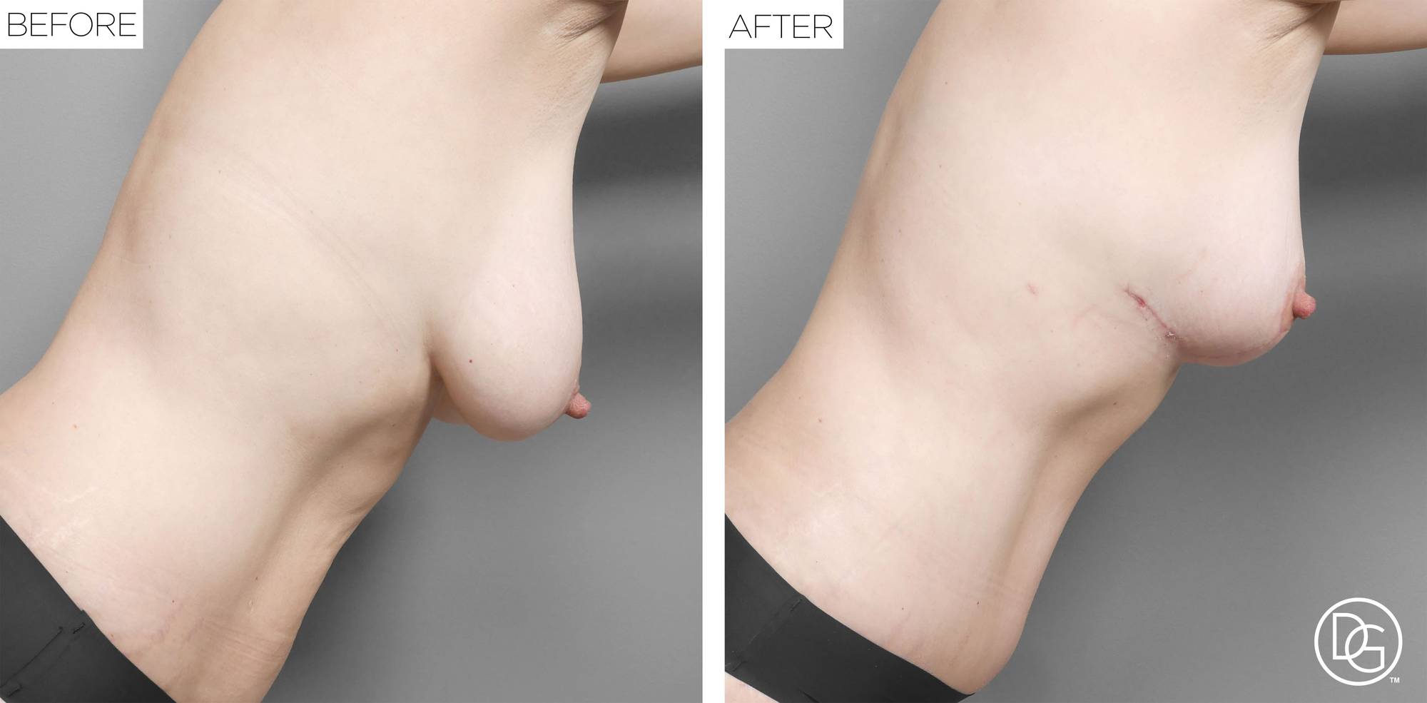 Before & After Image