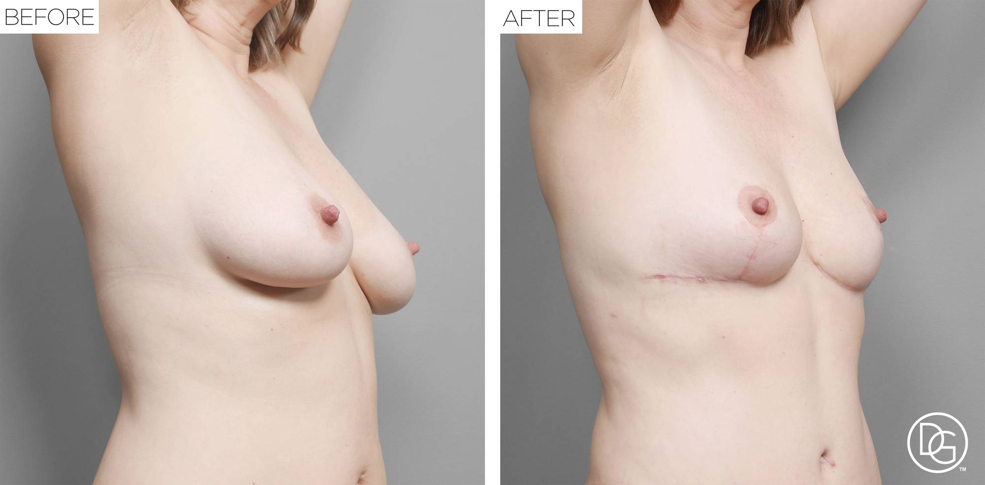 Before & After Image