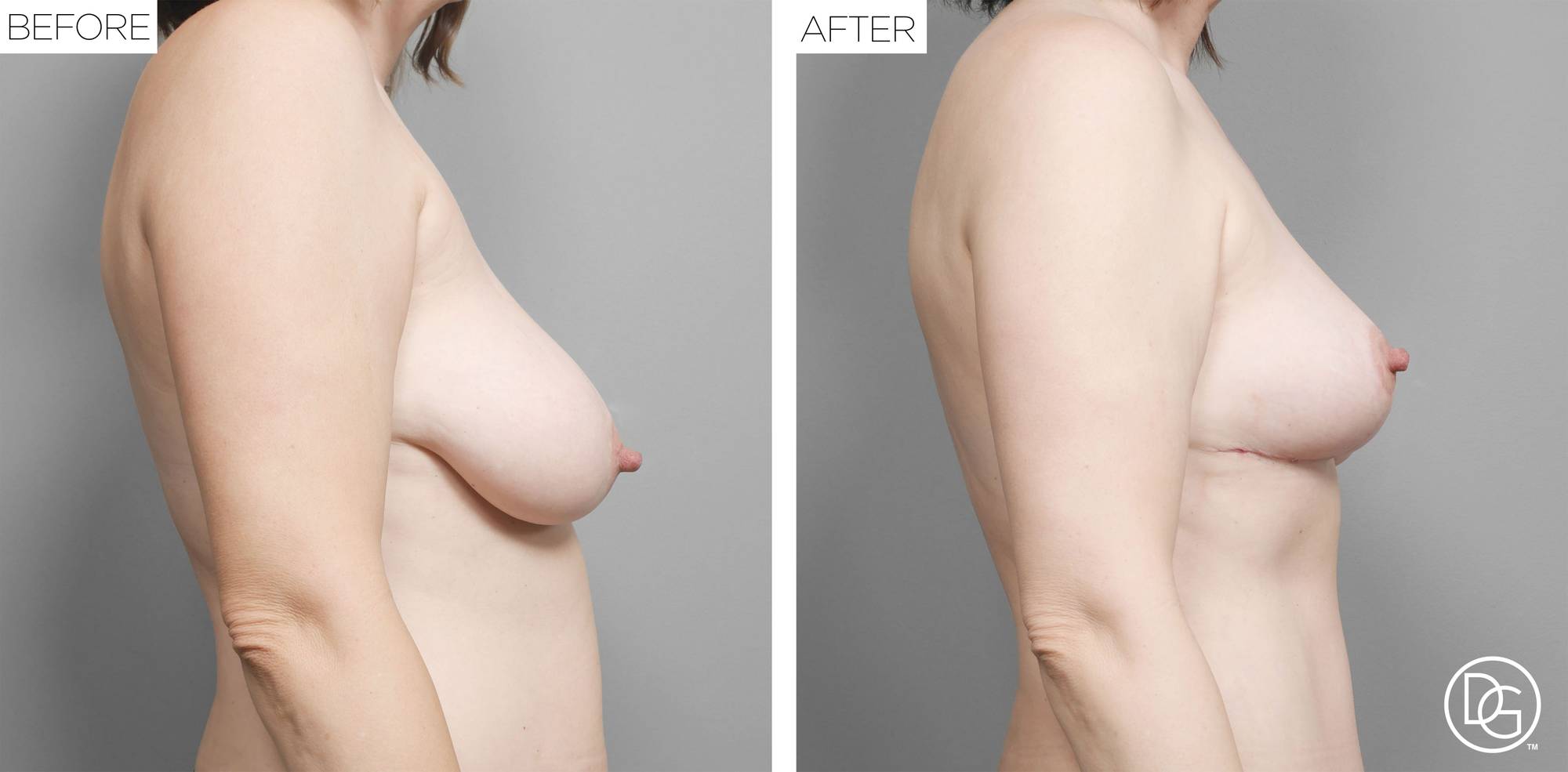 Before & After Image