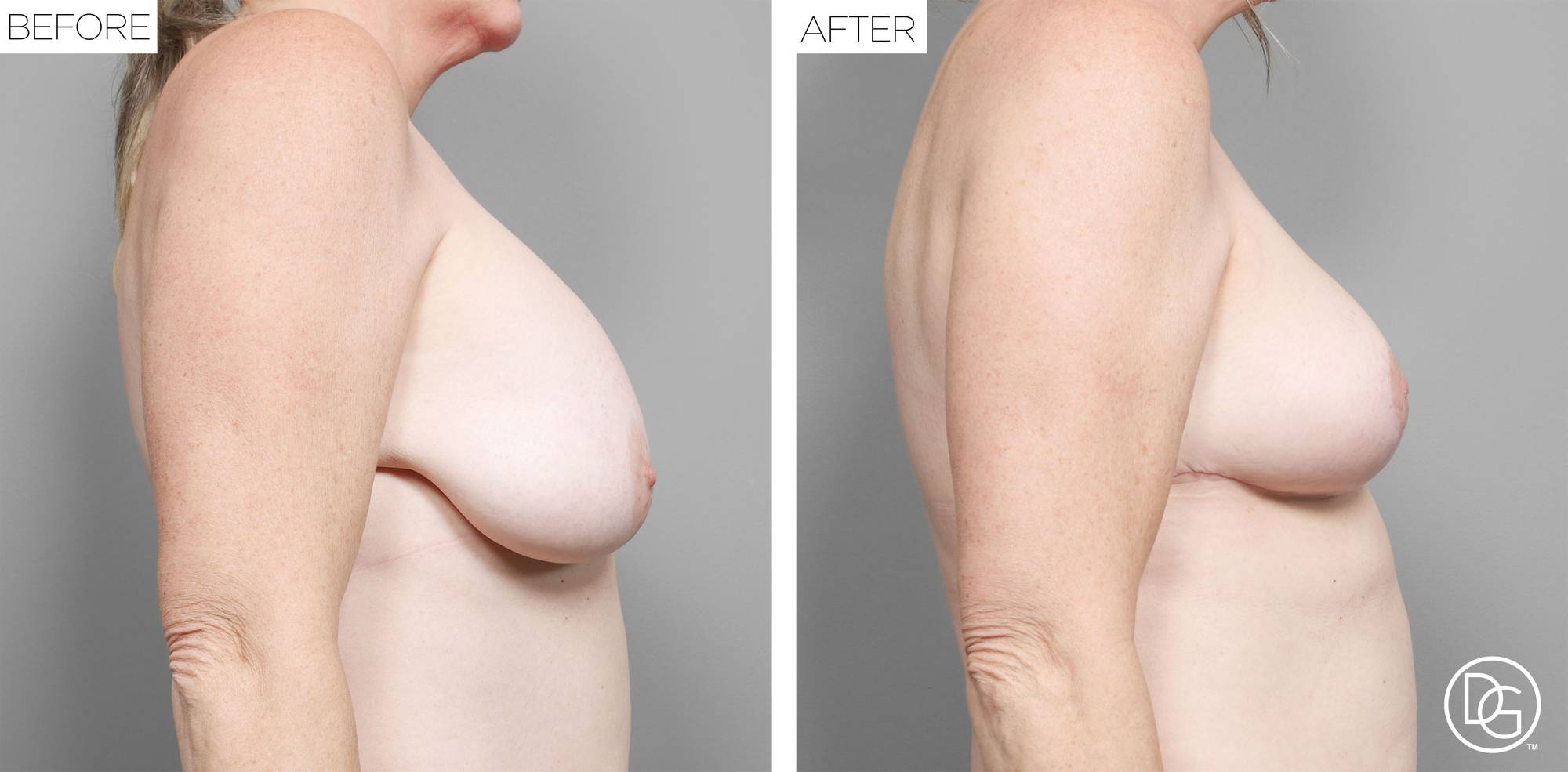 Before & After Image