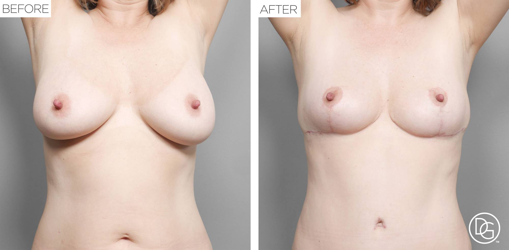 Before & After Image