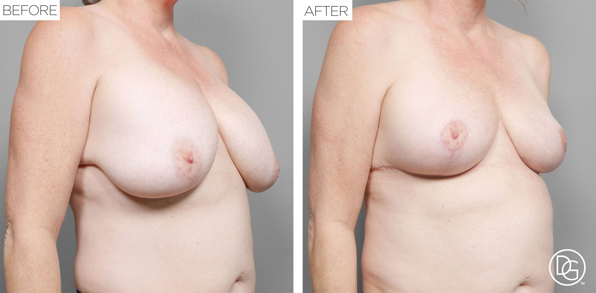 Before & After Image