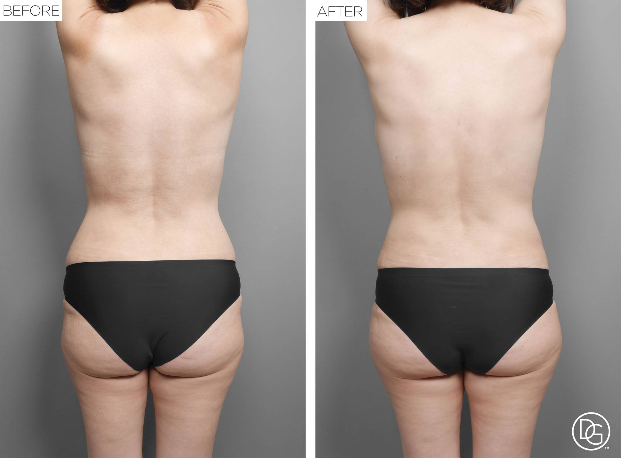 Before & After Image