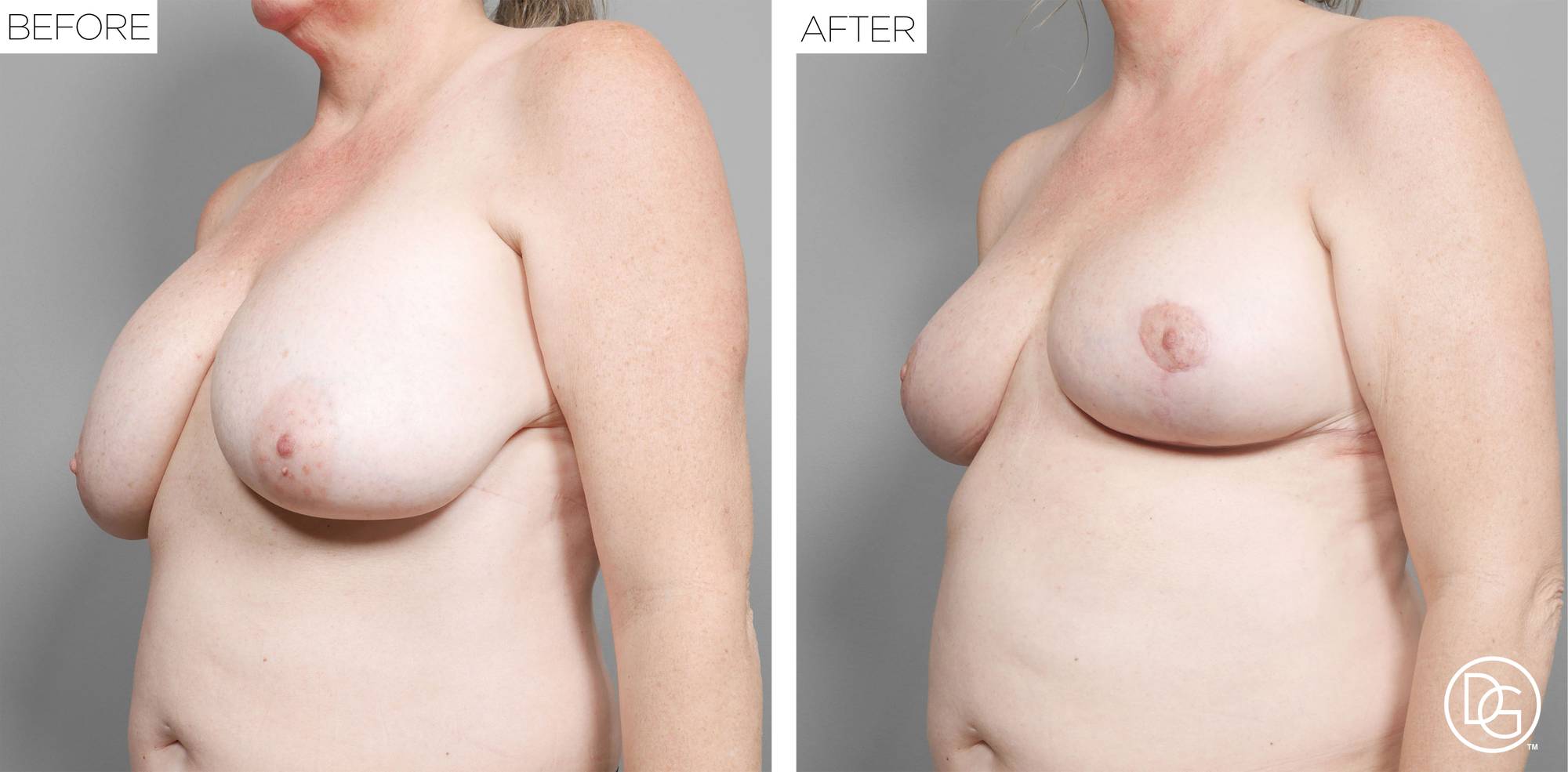 Before & After Image