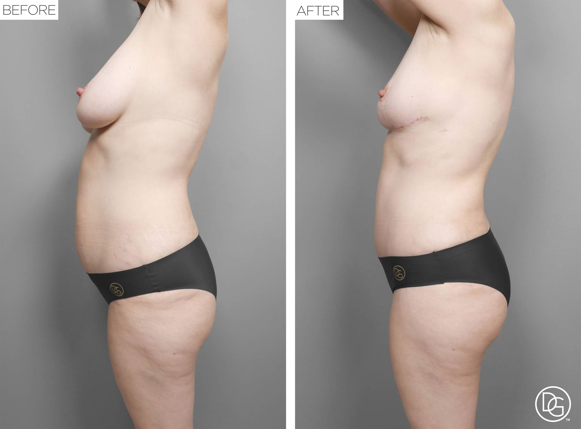 Before & After Image