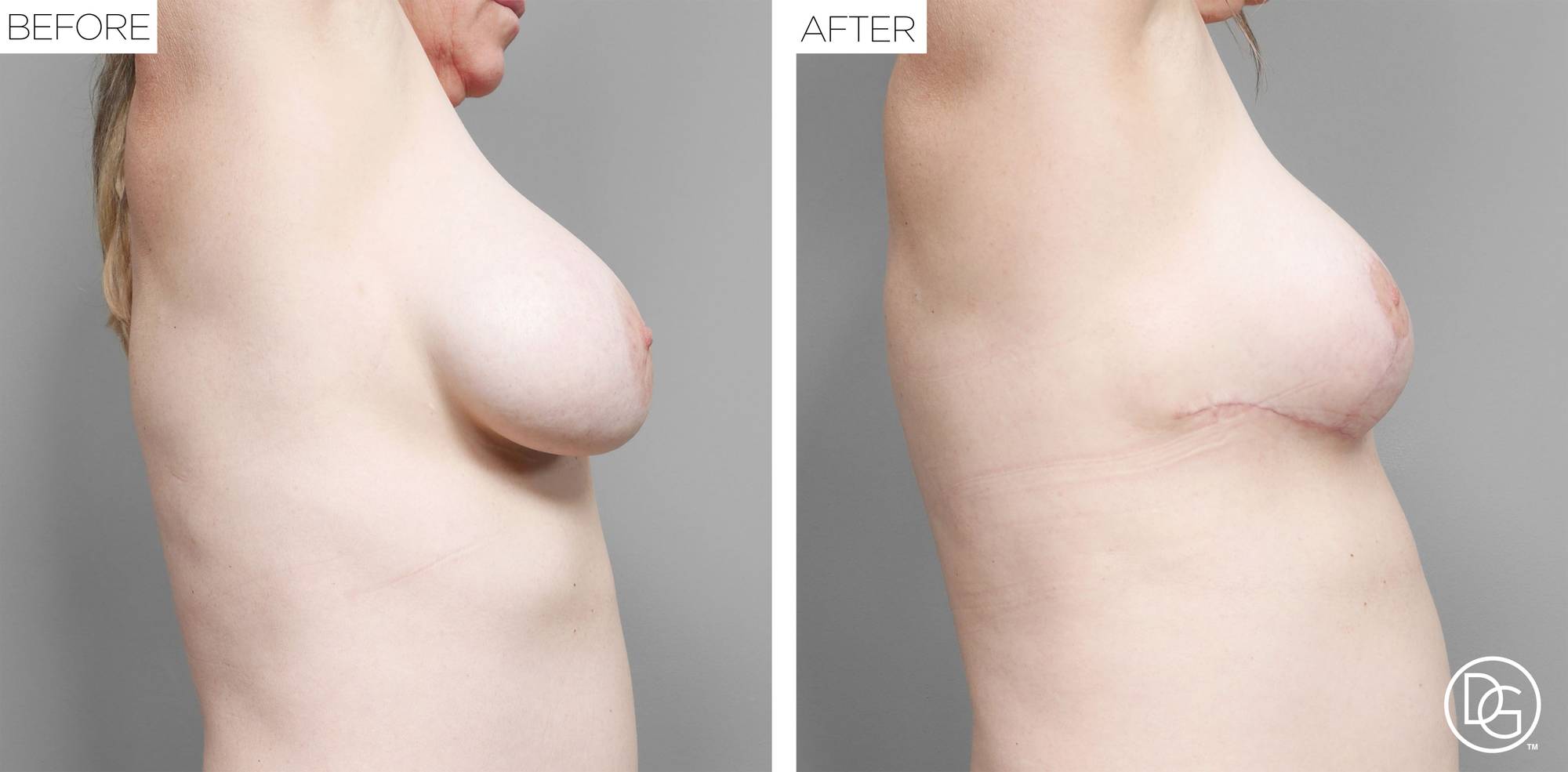 Before & After Image