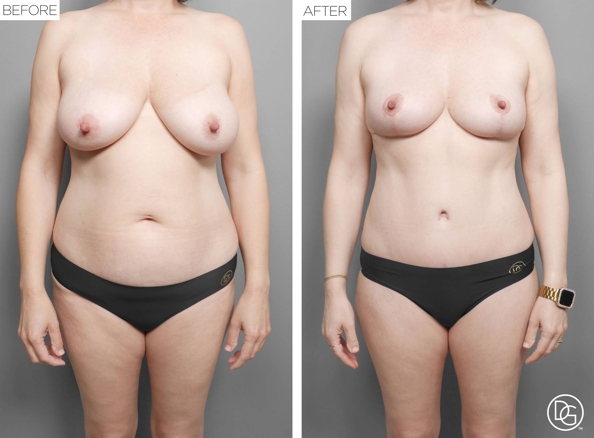 Before & After Image