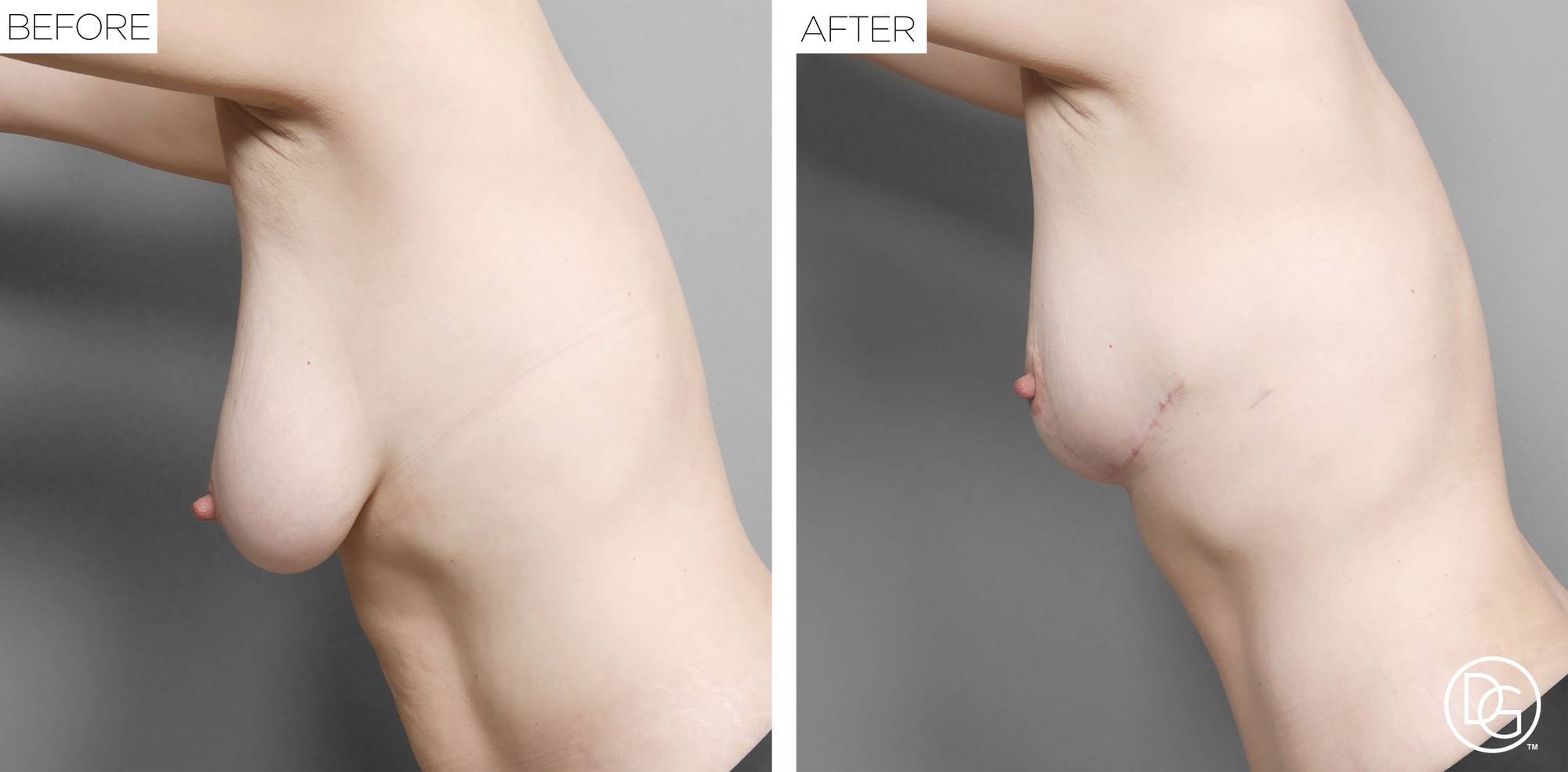 Before & After Image