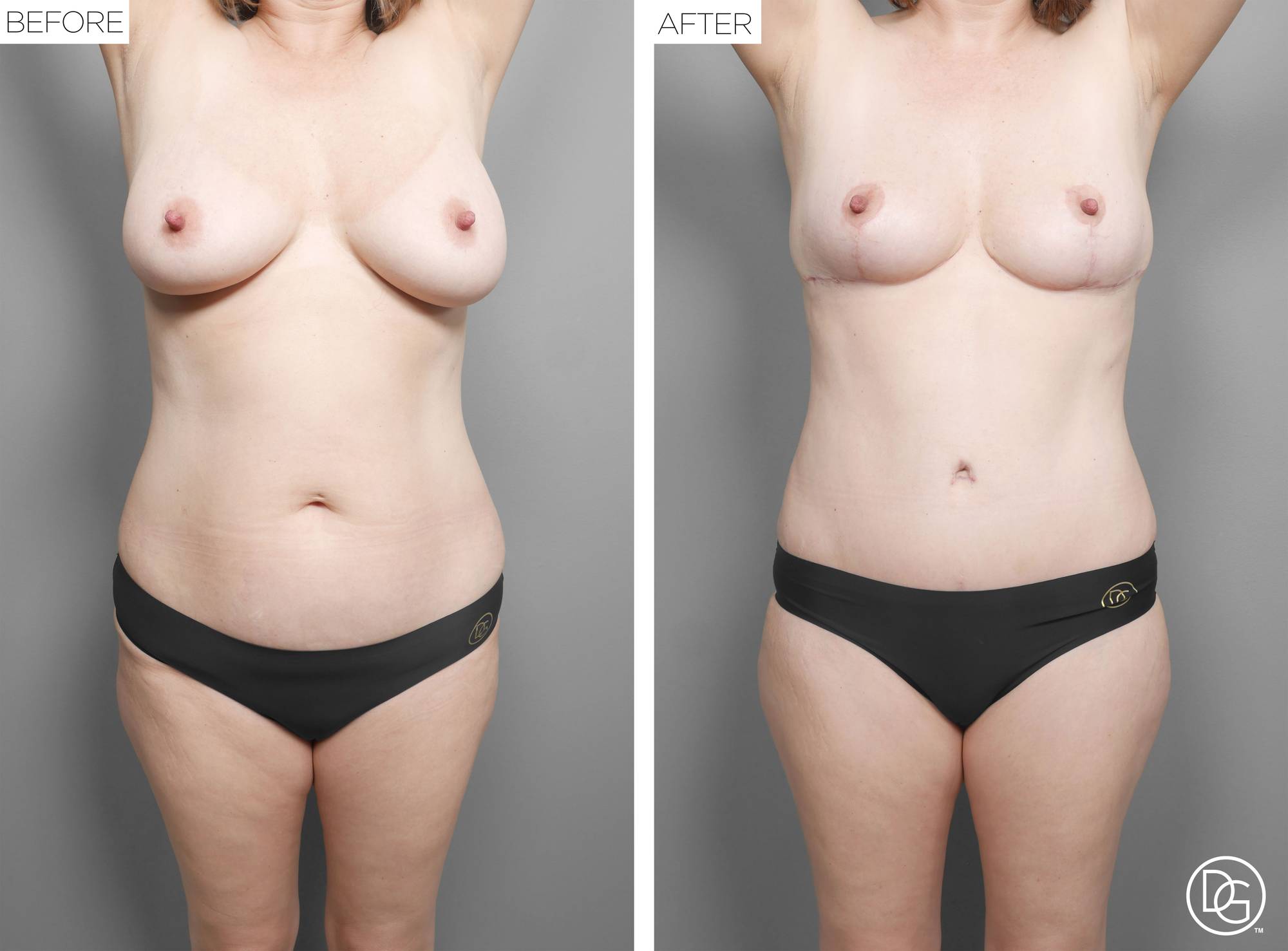 Before & After Image