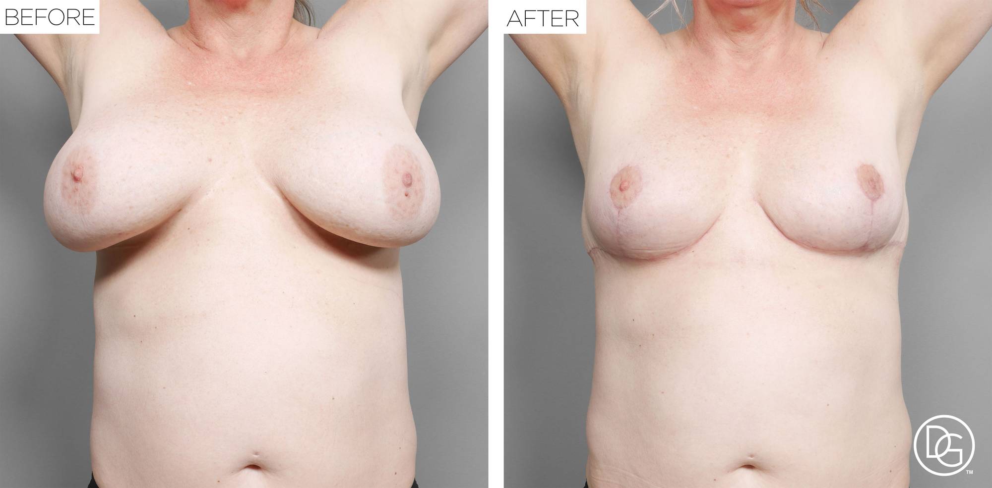 Before & After Image