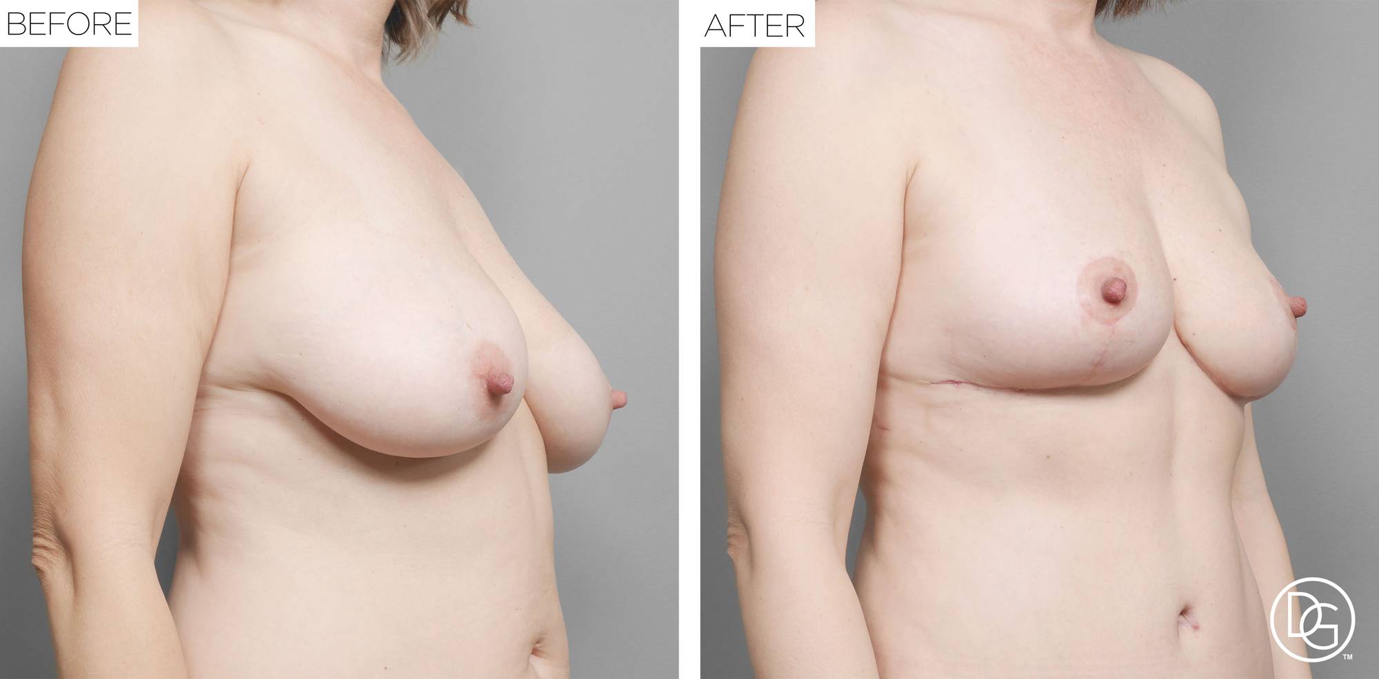 Before & After Image