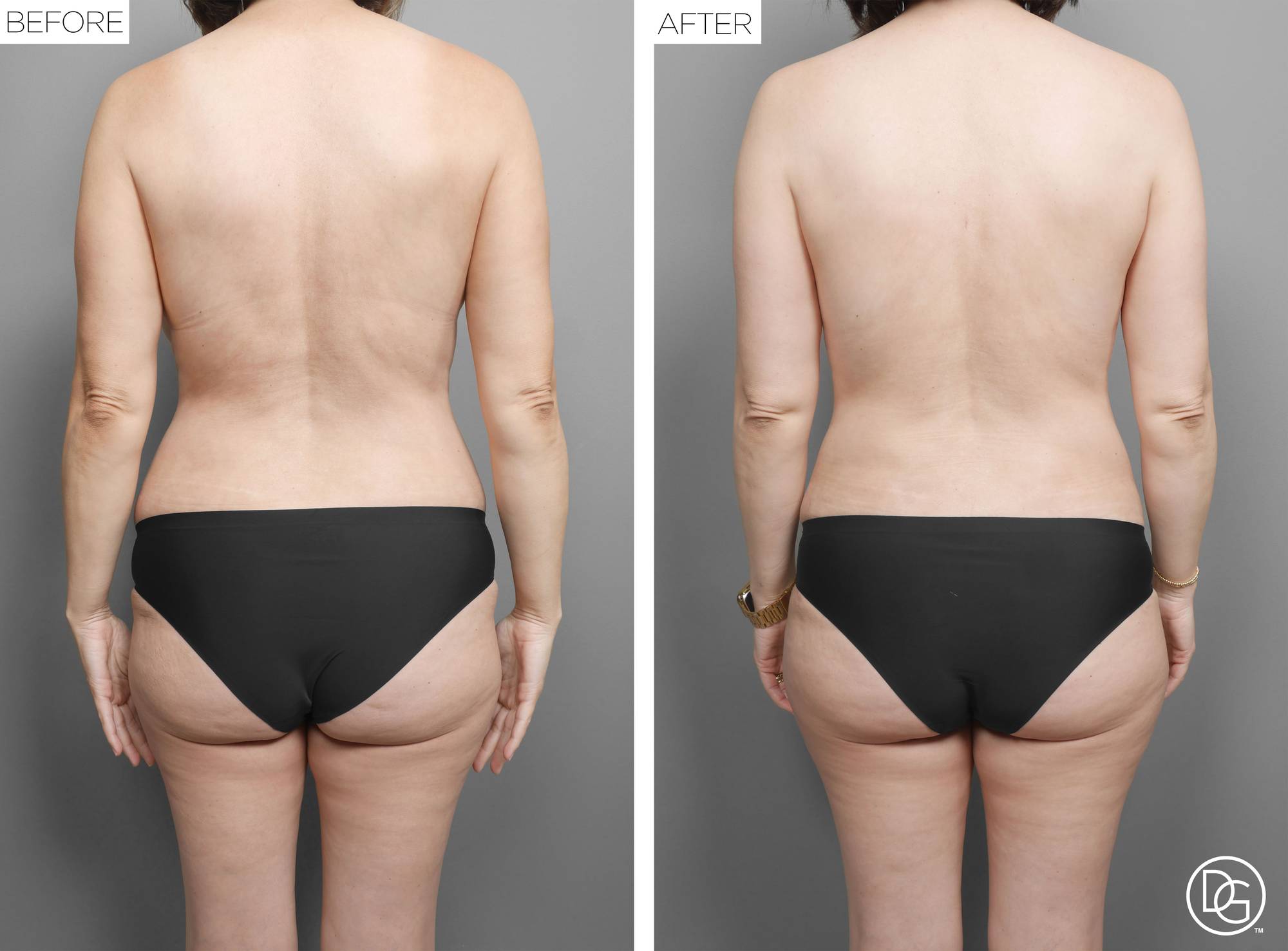 Before & After Image