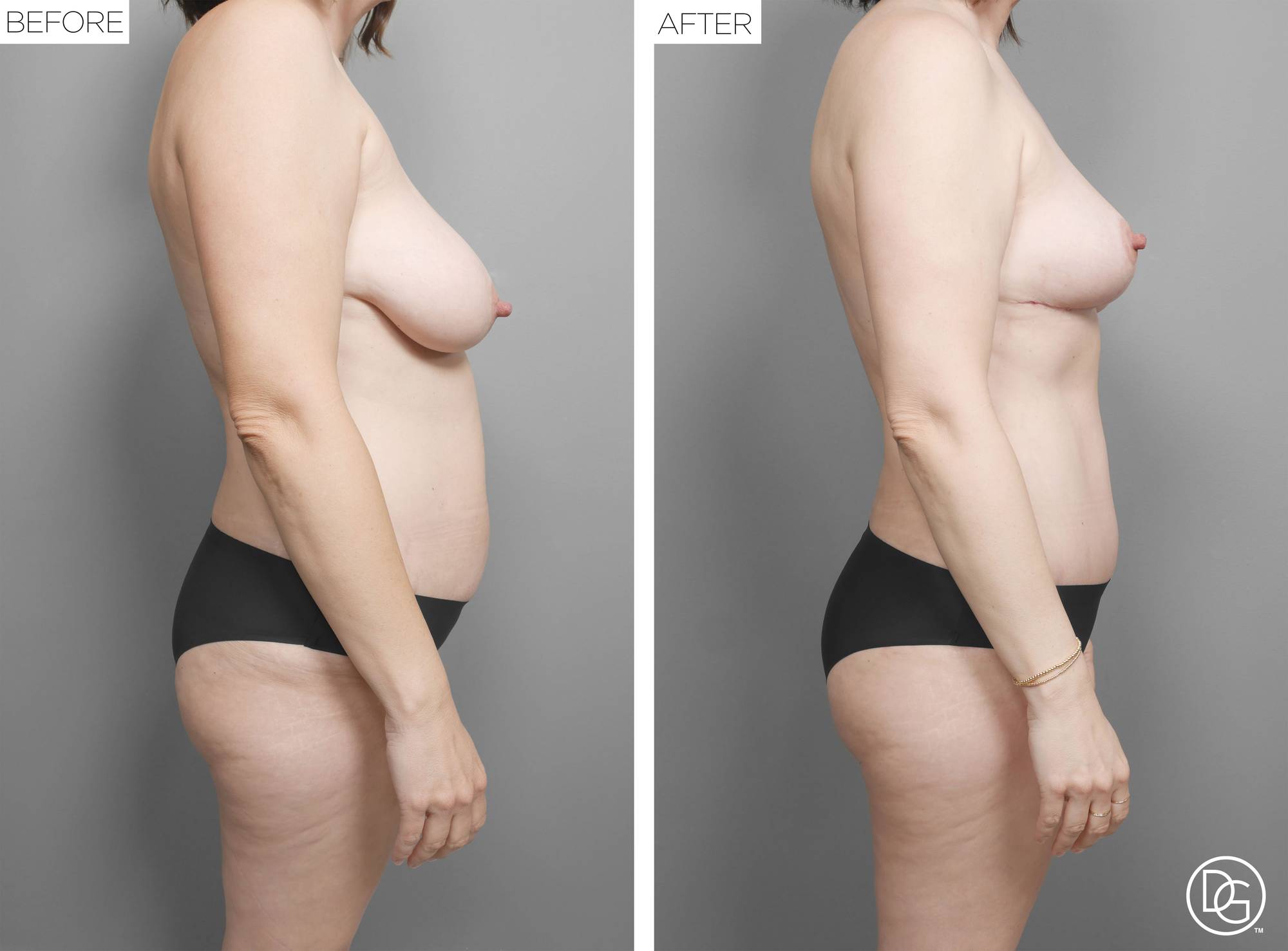 Before & After Image