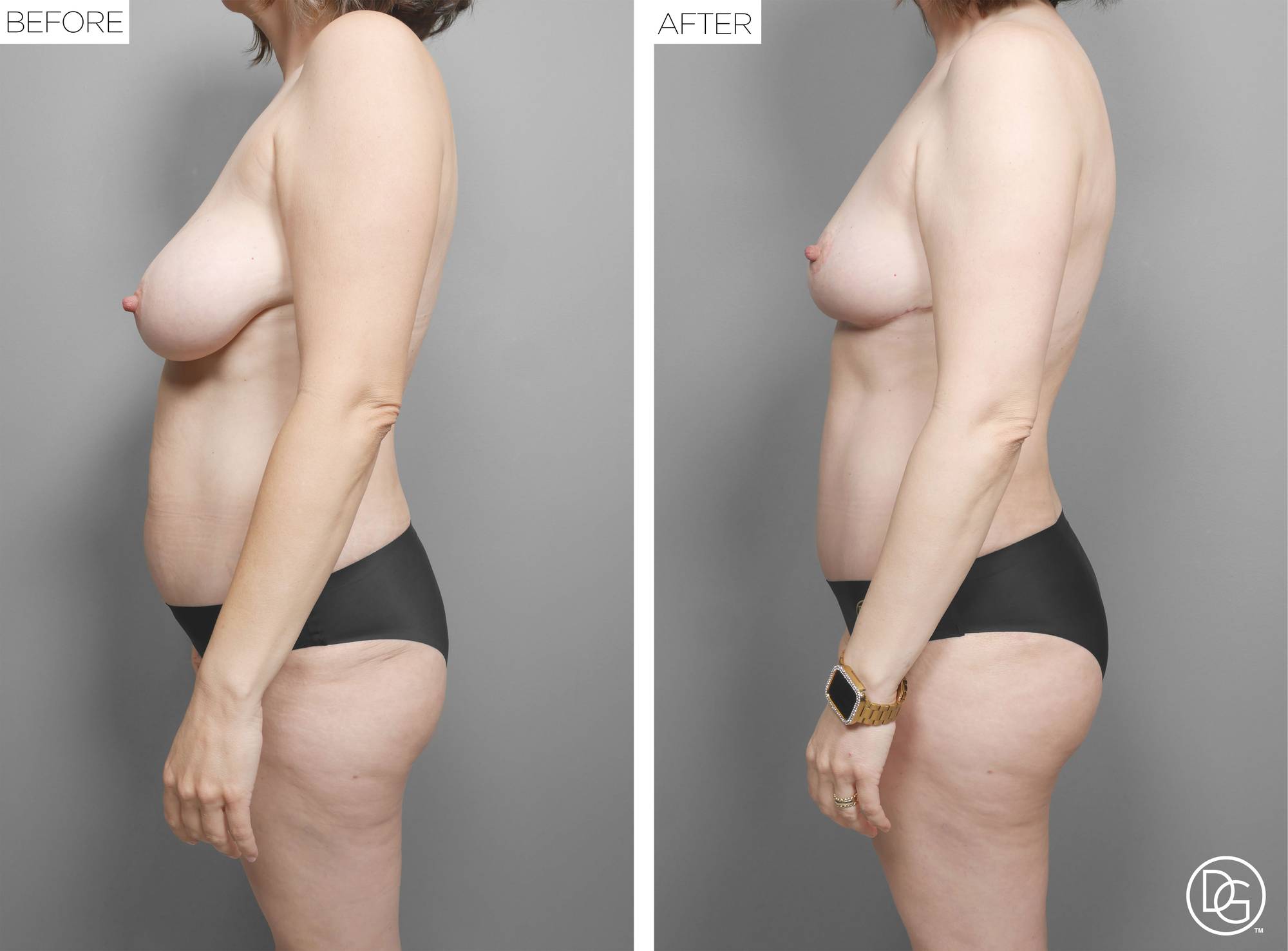 Before & After Image