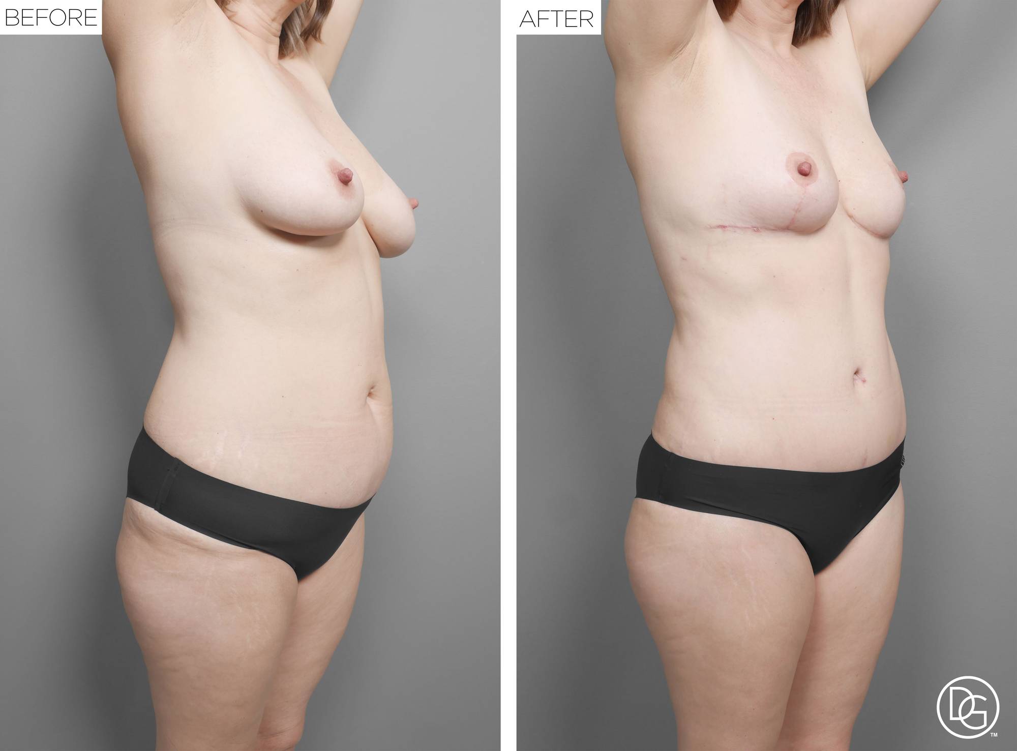 Before & After Image