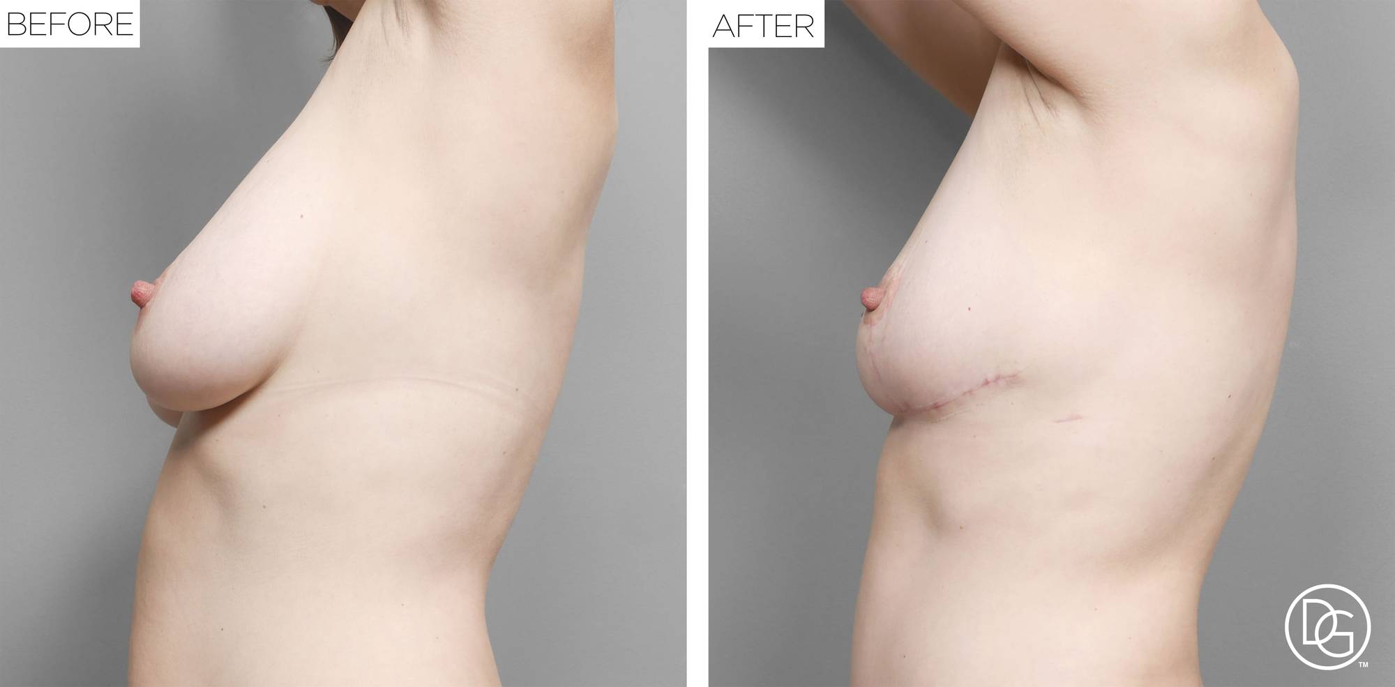 Before & After Image