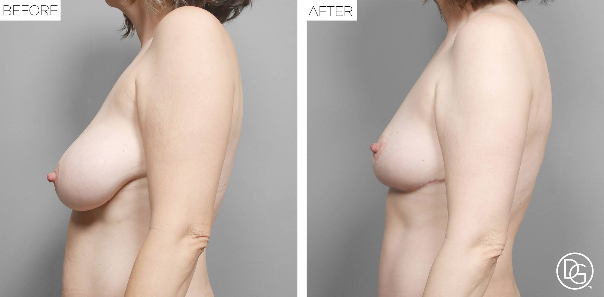 Before & After Image