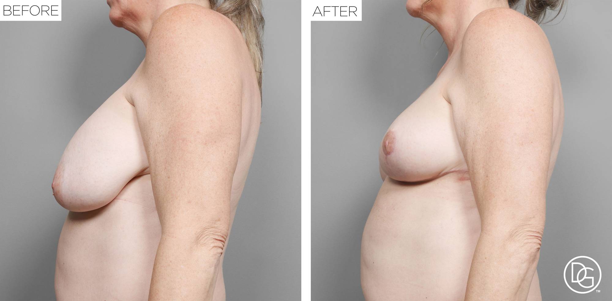 Before & After Image