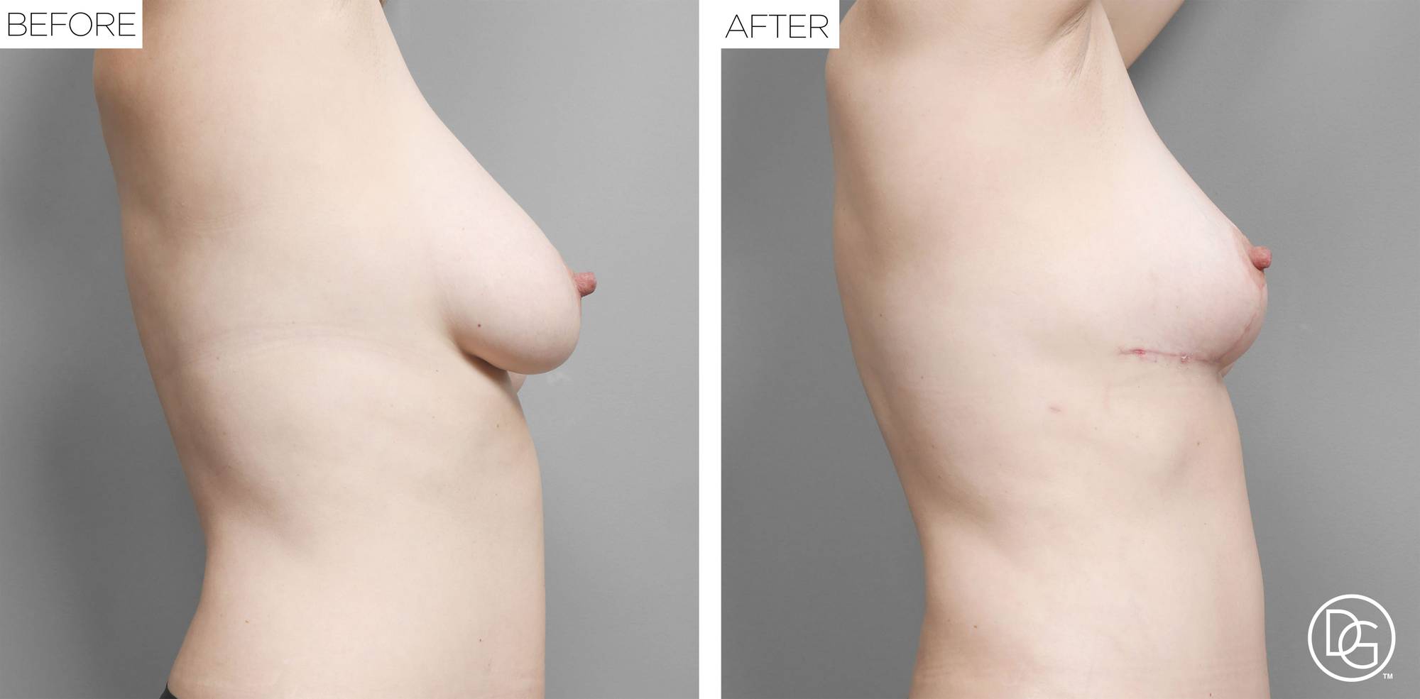 Before & After Image