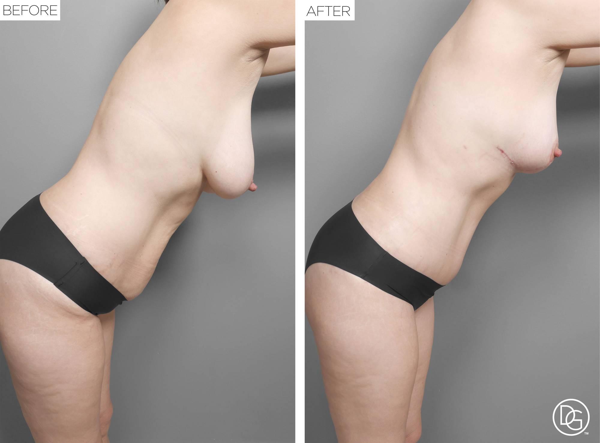 Before & After Image