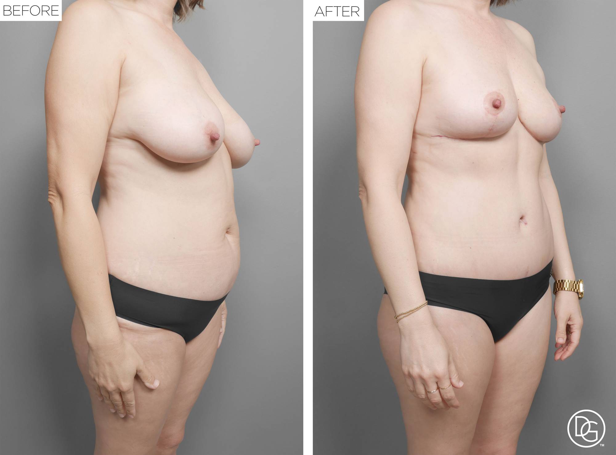 Before & After Image