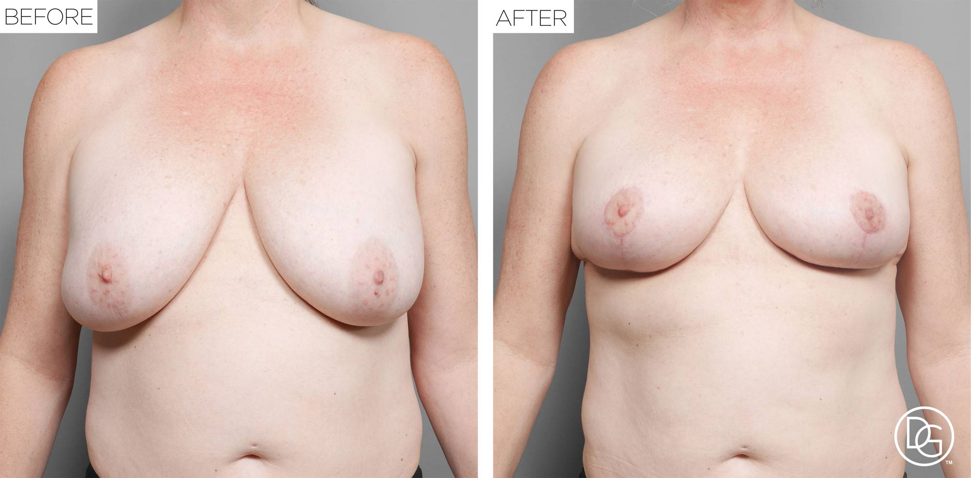 Before & After Image