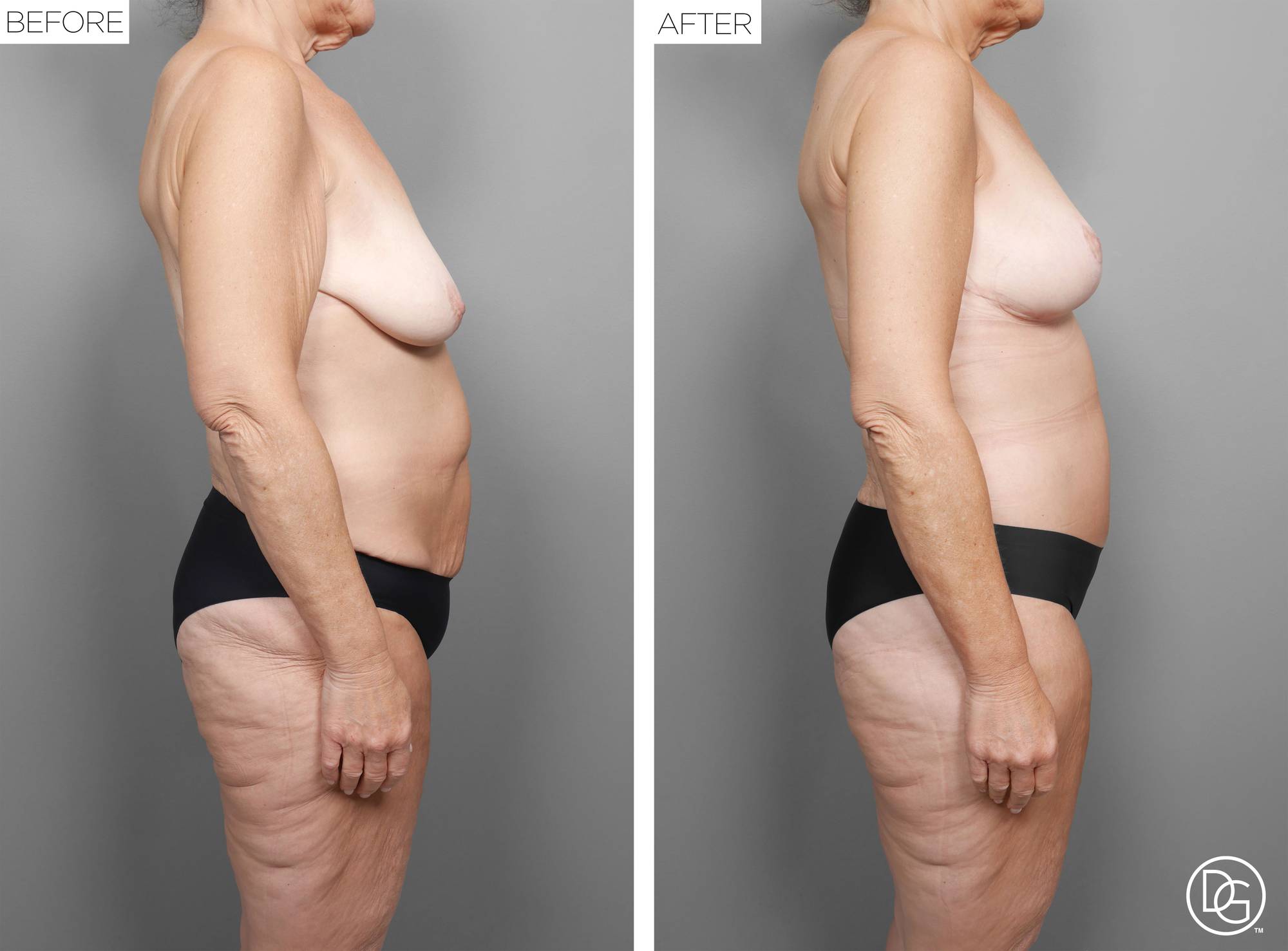 Before & After Image