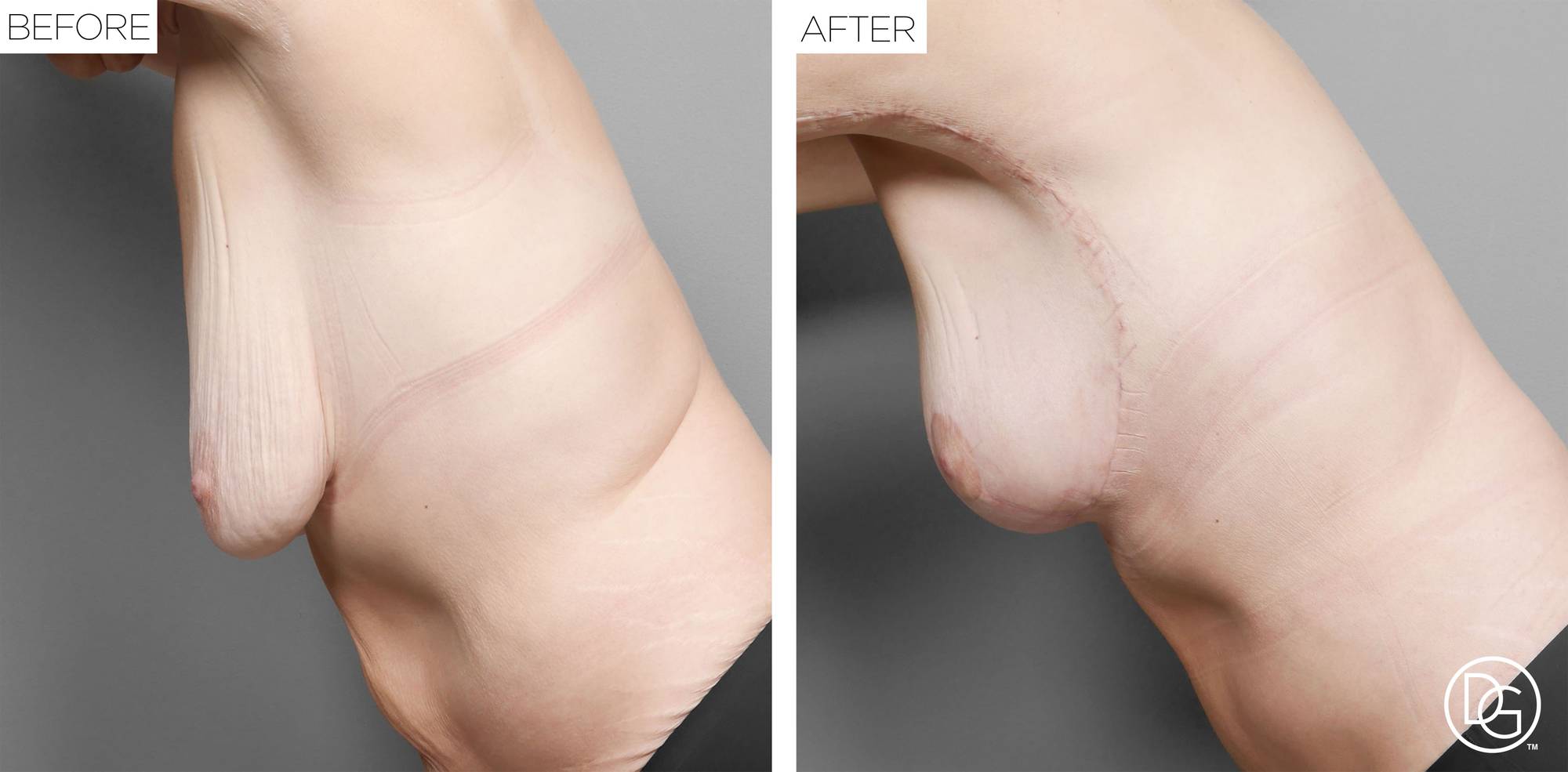 Before & After Image