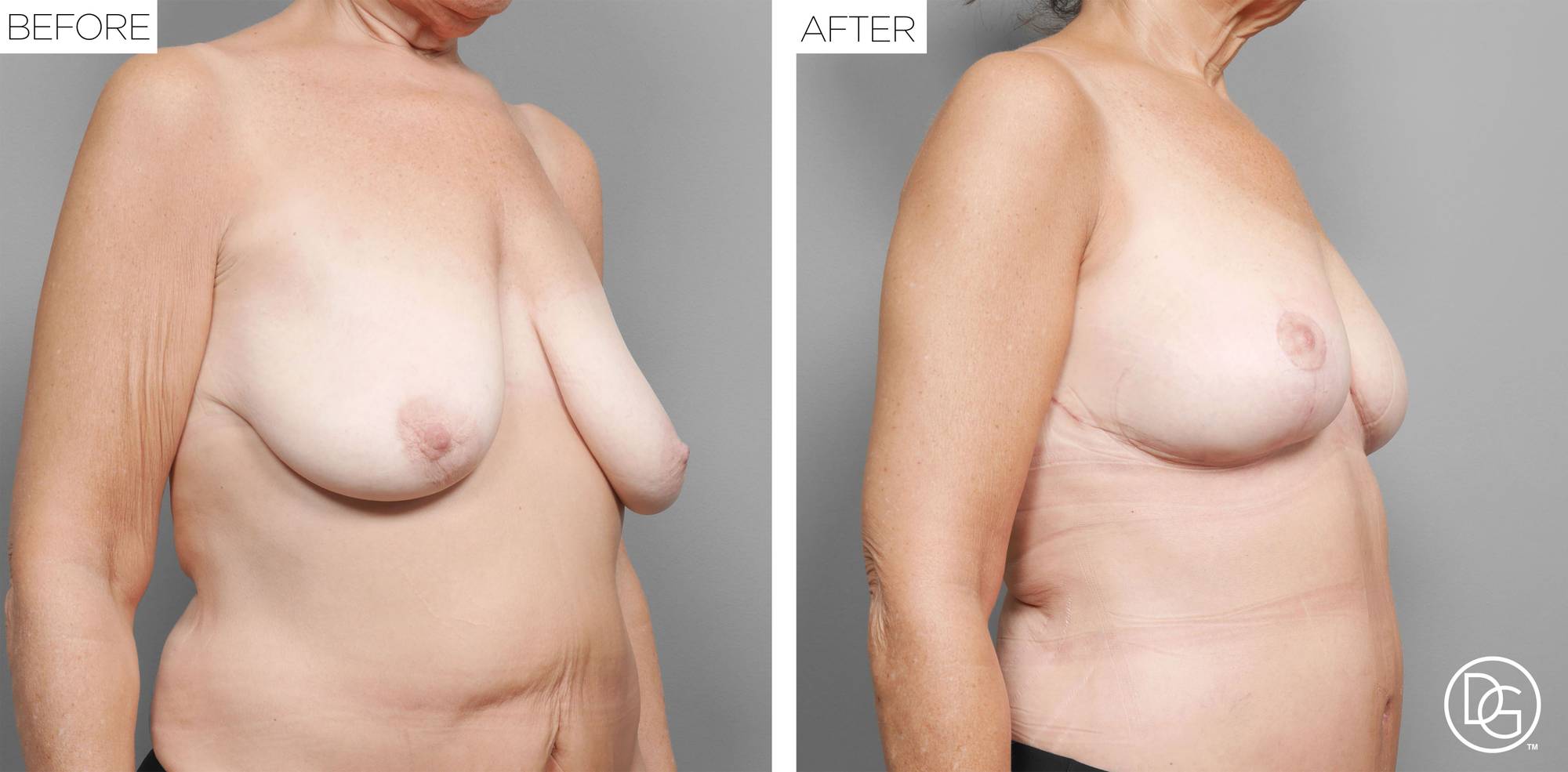 Before & After Image