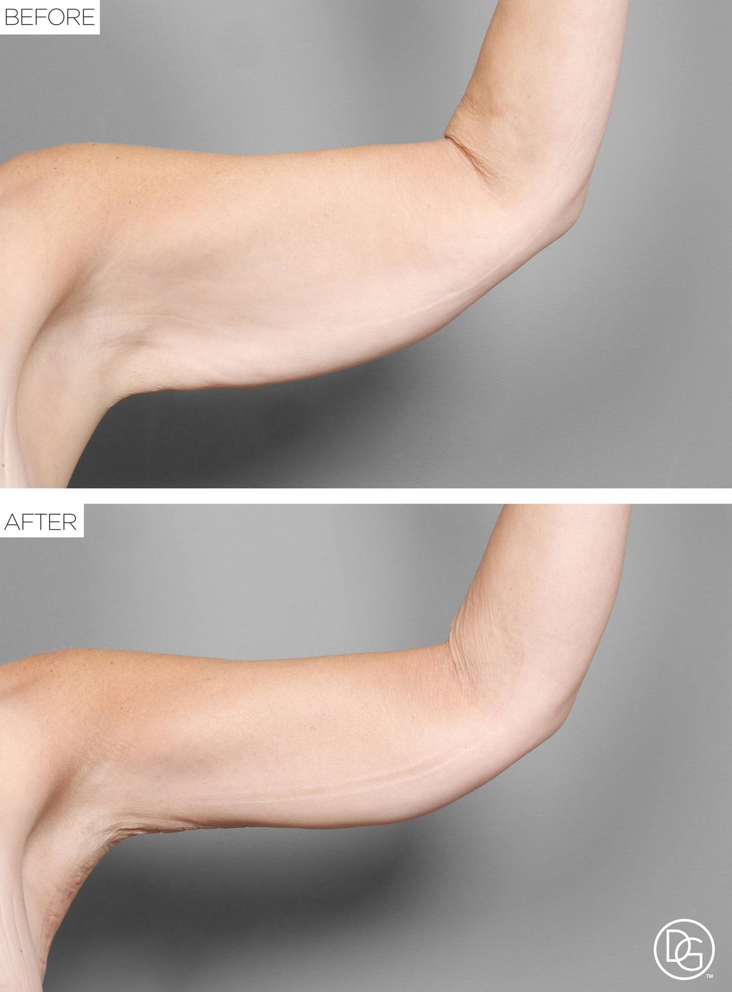 Before & After Image