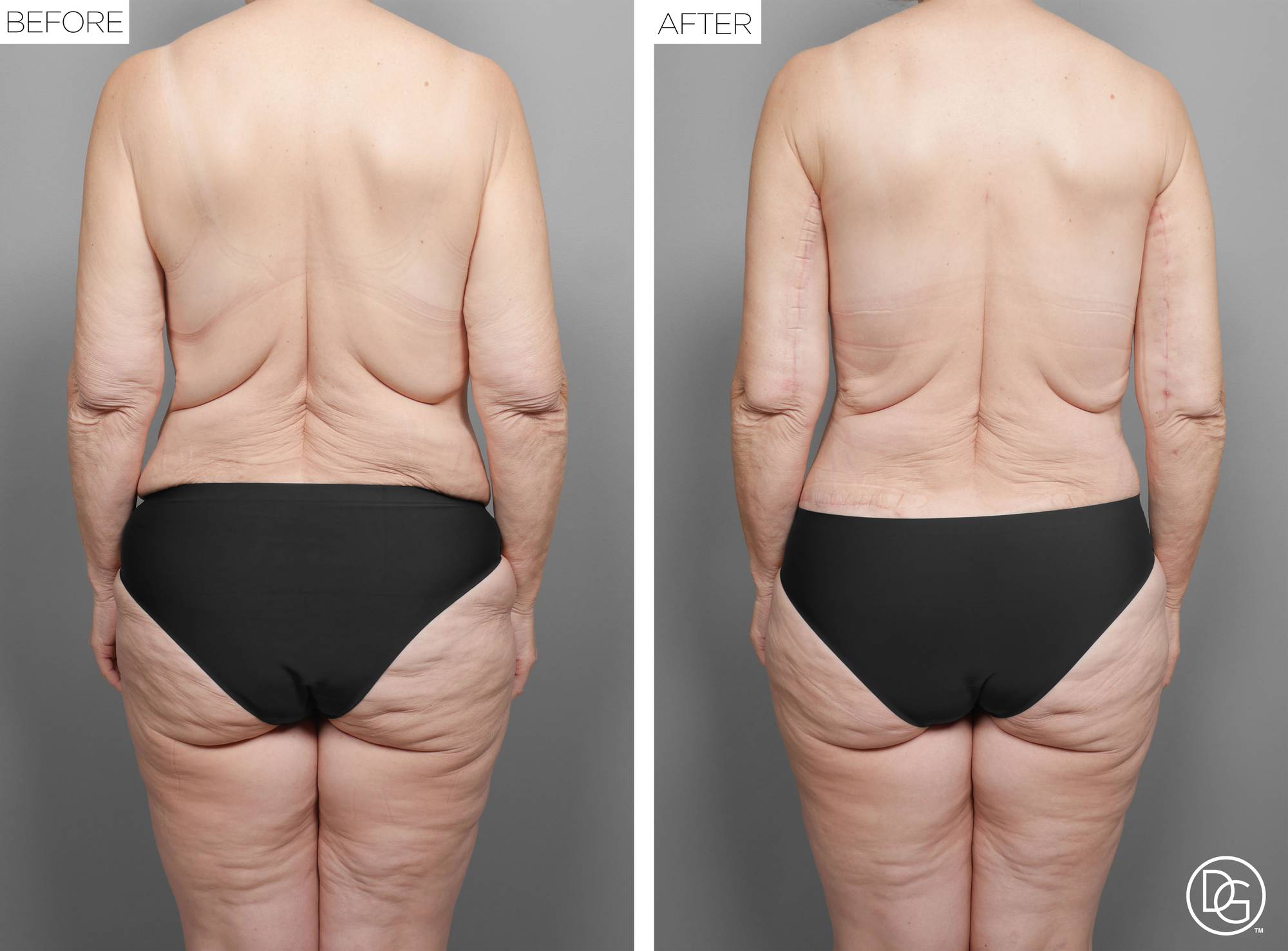 Before & After Image