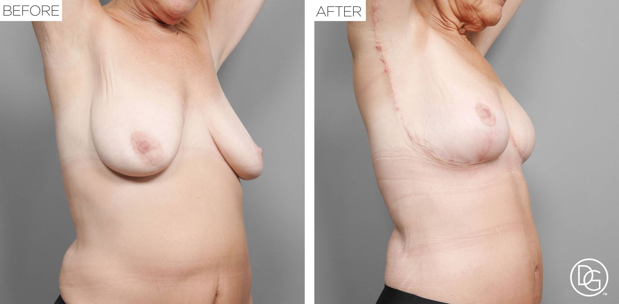 Before & After Image