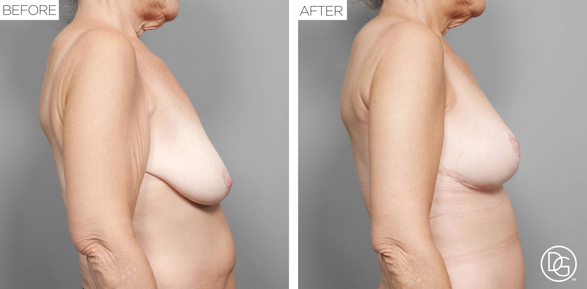 Before & After Image