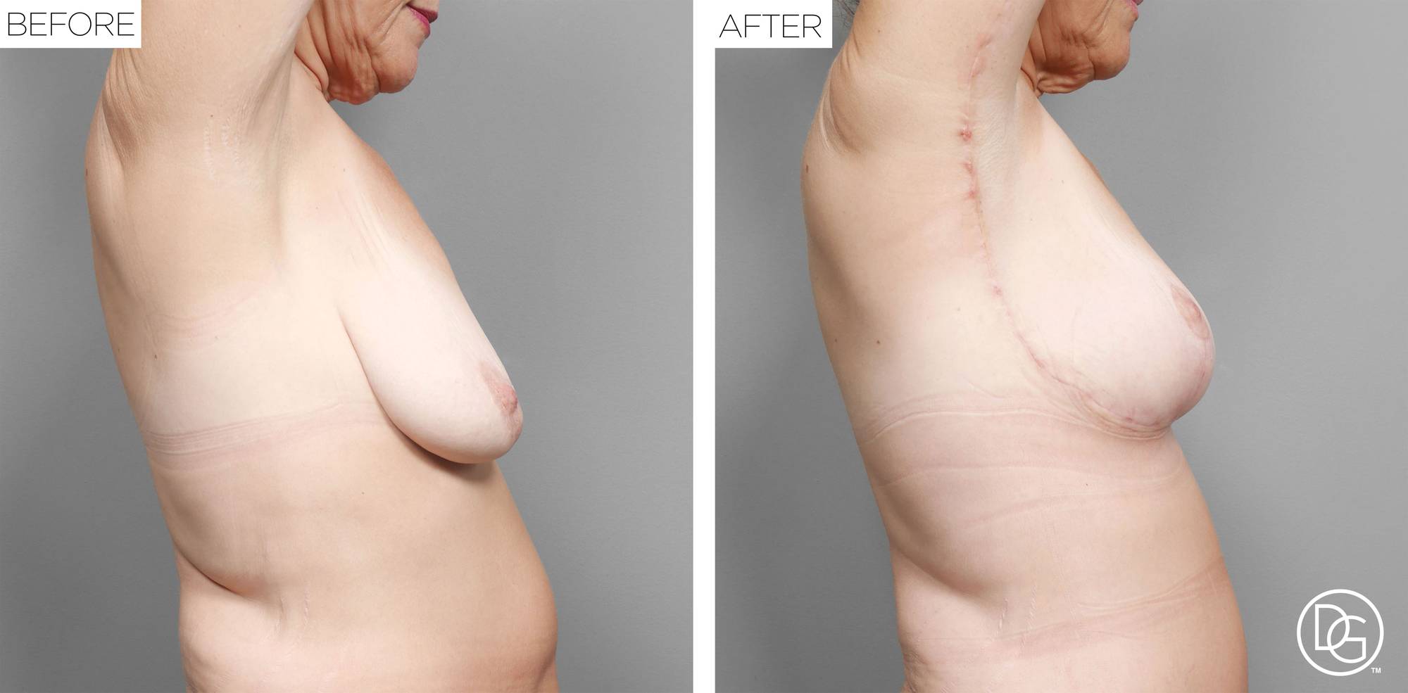 Before & After Image