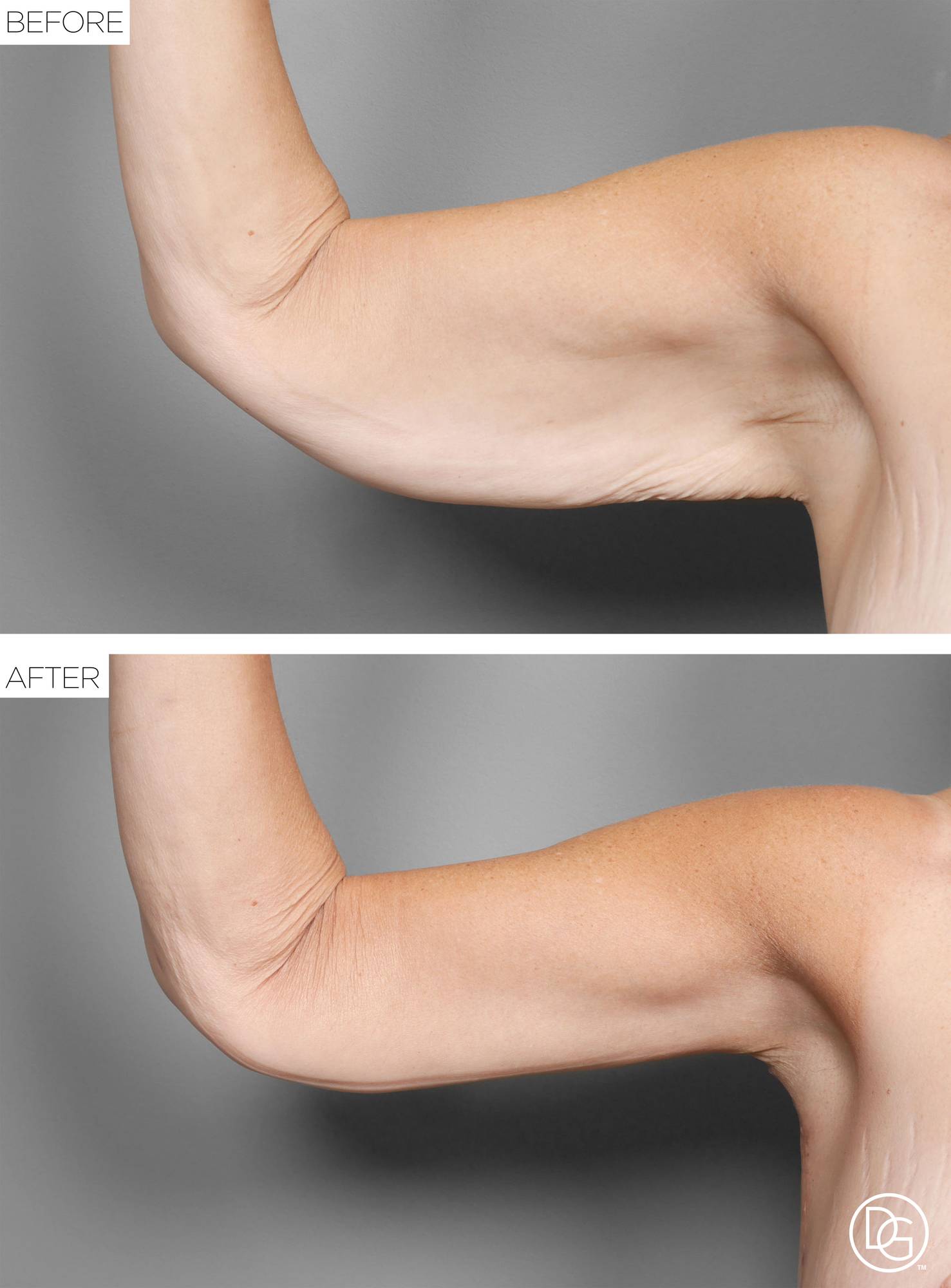 Before & After Image