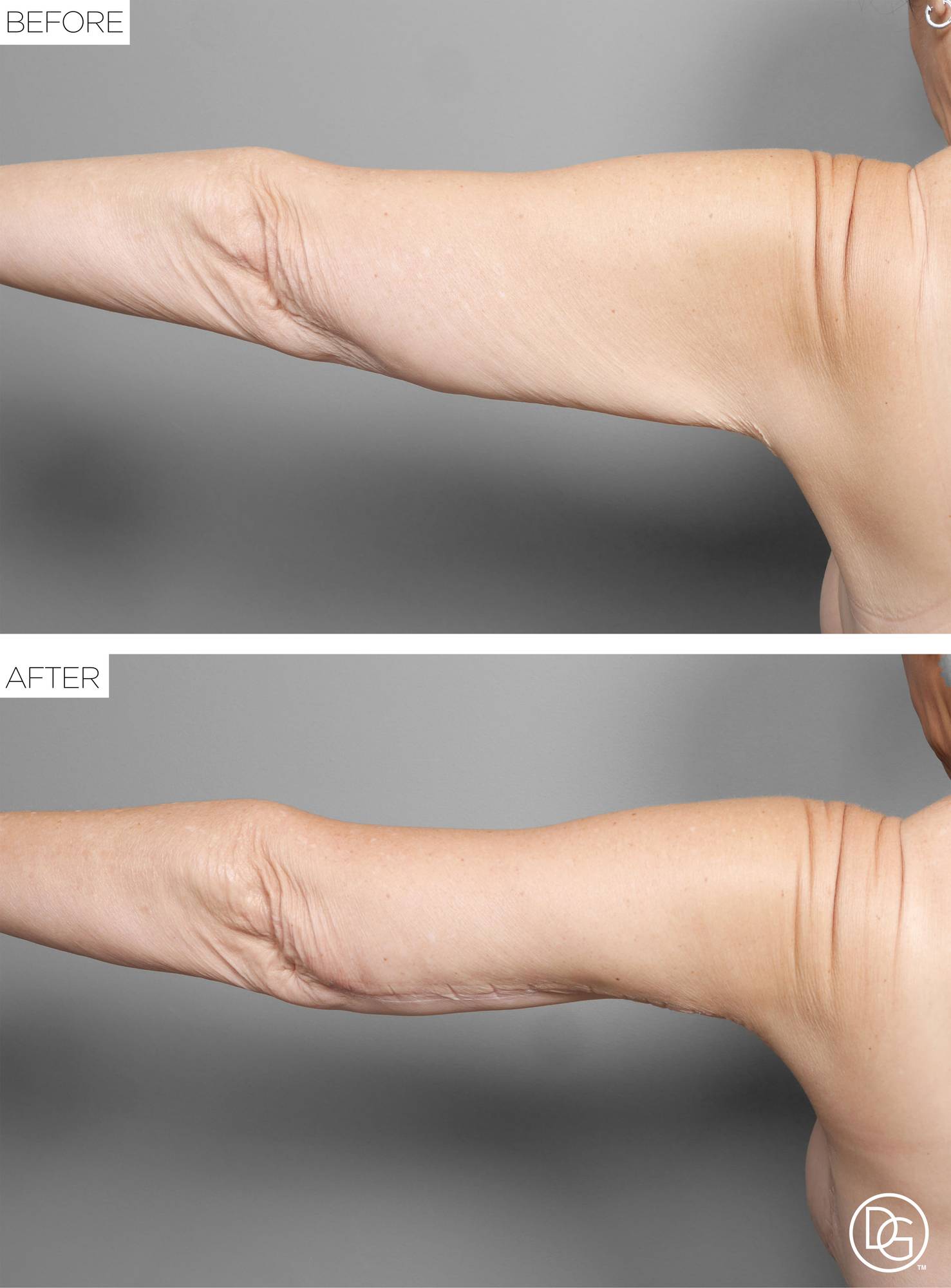 Before & After Image